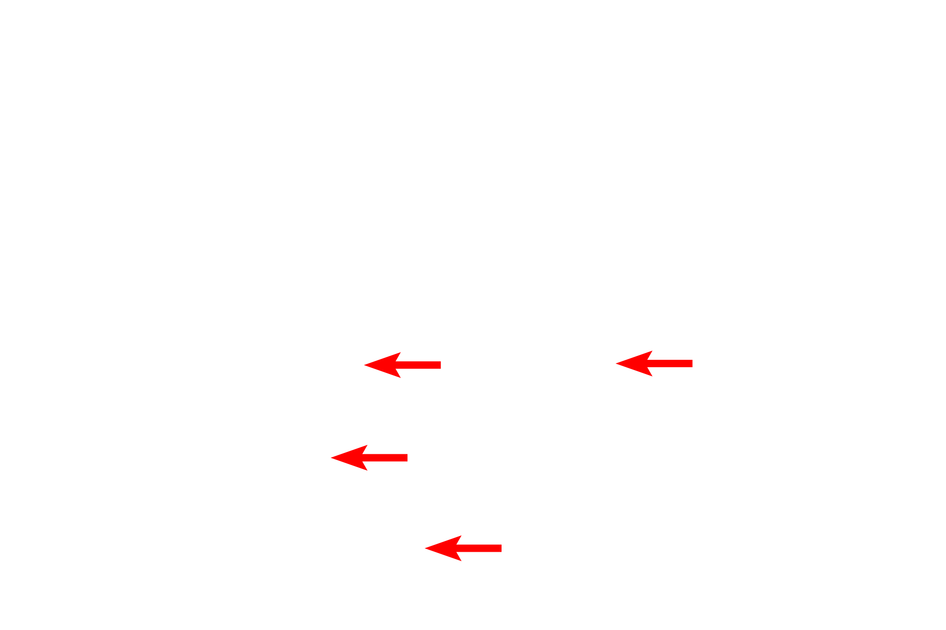 Empty lacunae <p>Degenerating cartilage cells enlarge (hypertrophy), mature, and secrete alkaline phosphatase, which facilitates calcification of the matrix. A calcified matrix prohibits diffusion of nutrients, so chondrocytes die, leaving empty lacunae surrounded by a calcified cartilage matrix. These regressive stages occur in the aging process as well as in the epiphyseal plates of growing long bones.</p>
