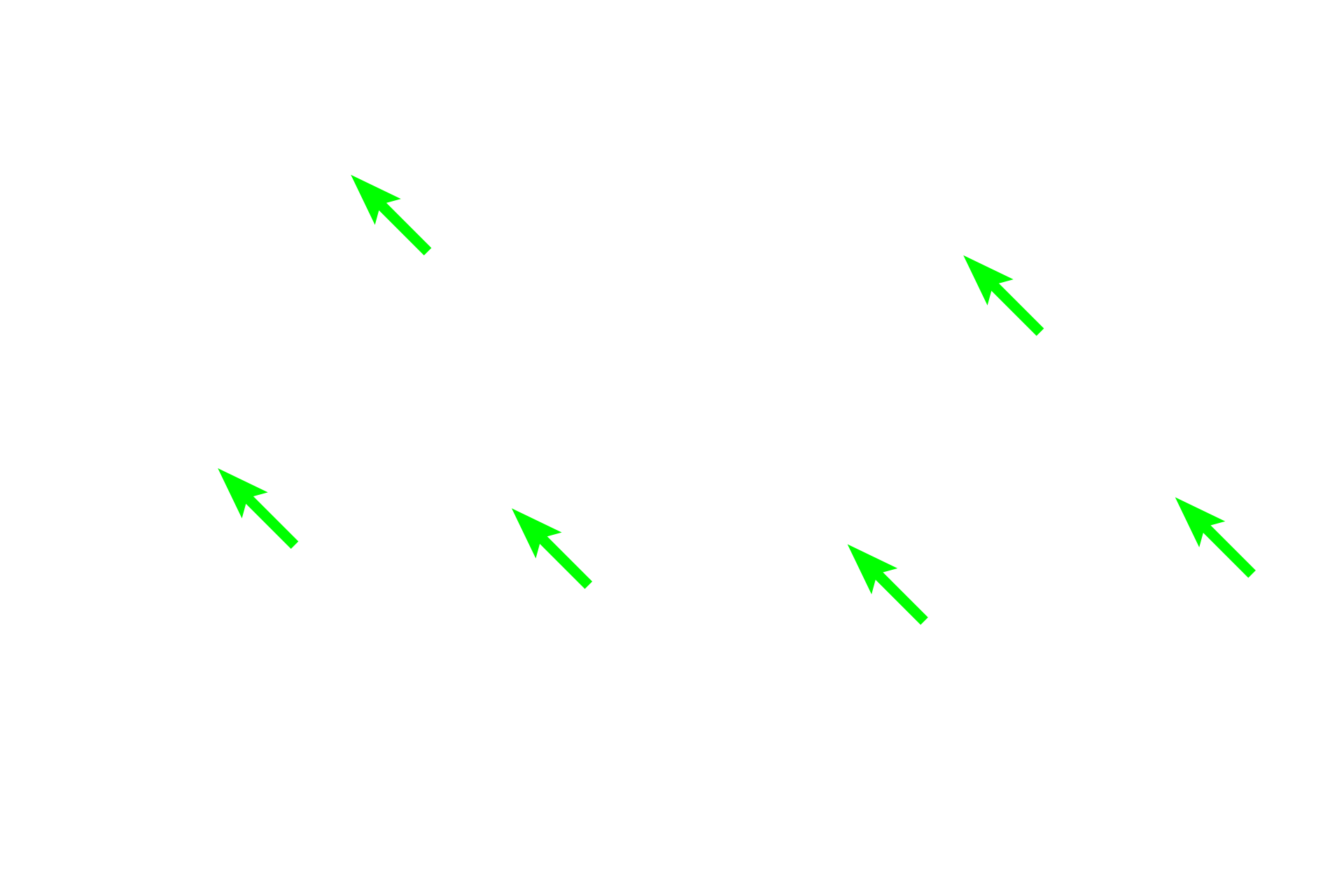 Chrondrocytes <p>These images compare the appearance of elastic cartilage stained with hematoxylin and eosin (left) and hematoxylin and eosin plus orcein for elastic fibers on the right. 400x</p>
