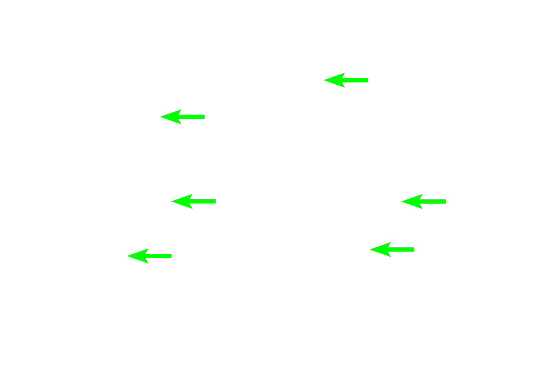 Elastic fibers <p>These images compare the appearance of elastic cartilage stained with hematoxylin and eosin (left) and hematoxylin and eosin plus orcein for elastic fibers on the right. 400x</p>
