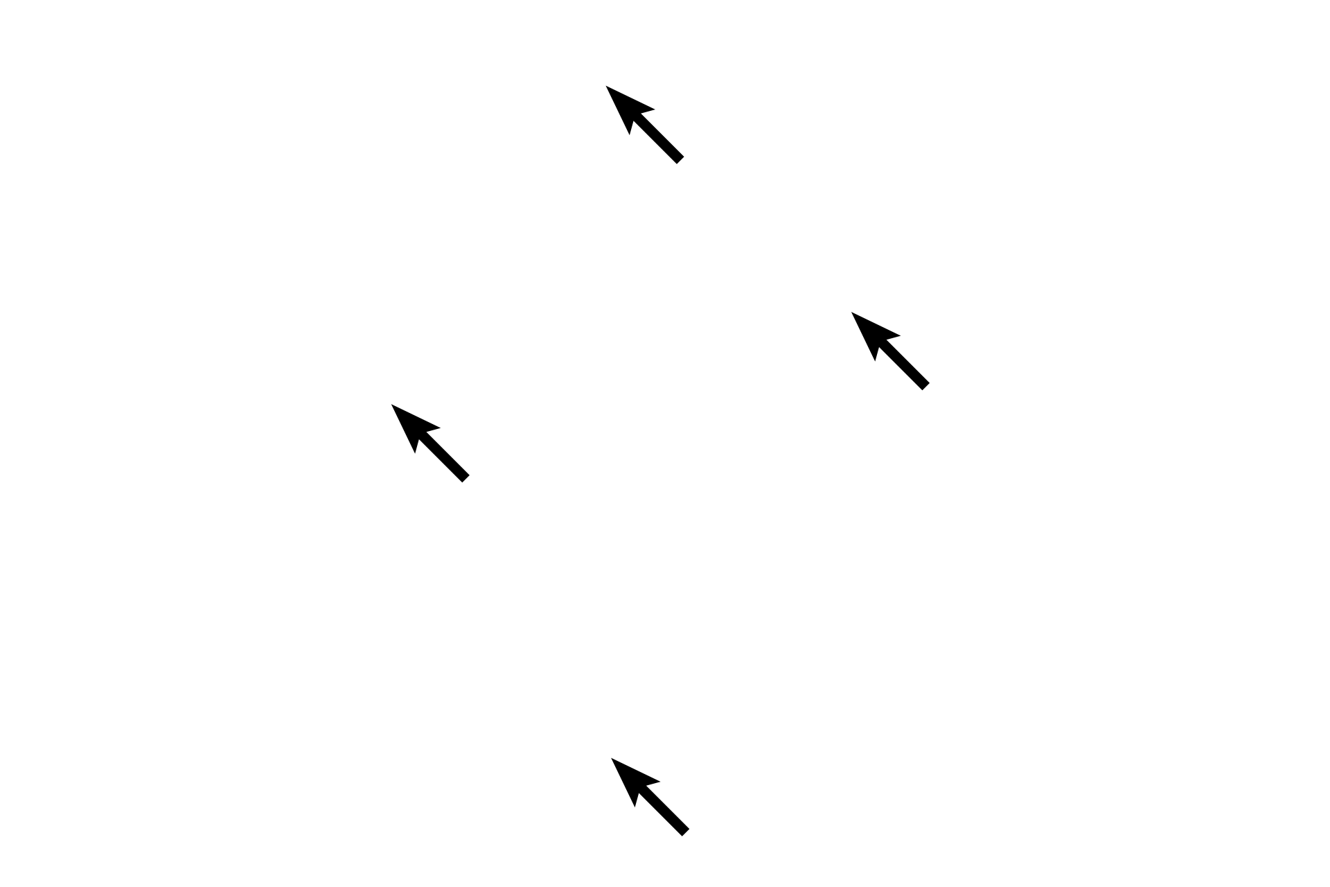  - Spongy bone <p>The diaphysis, or shaft, of a long bone extends longitudinally down the image. The shaft is composed of compact bone peripherally; the center of the shaft, the marrow cavity, is composed of spongy bone surrounded by bone marrow.</p>
