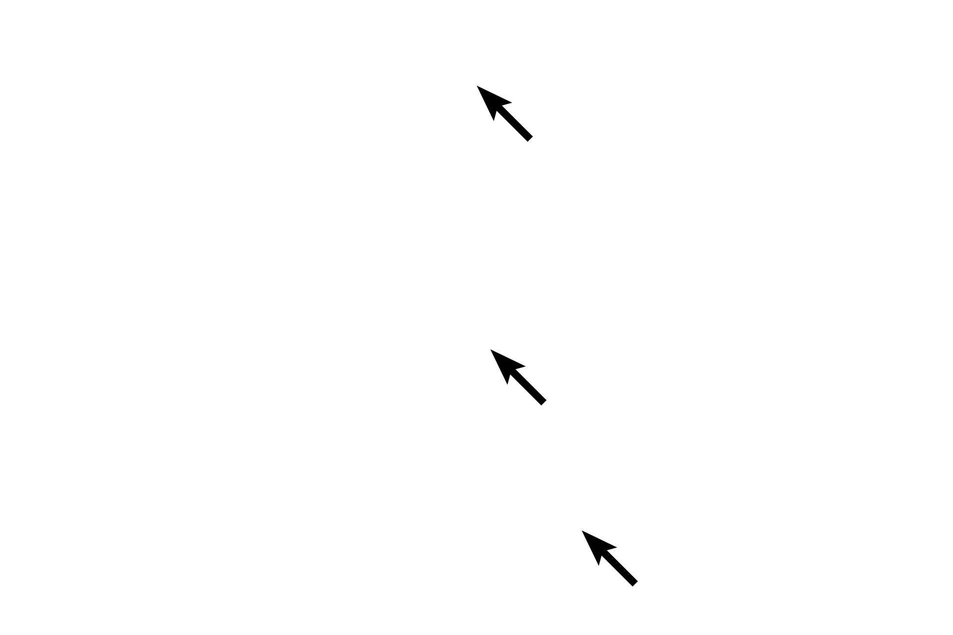  - Bone marrow <p>The diaphysis, or shaft, of a long bone extends longitudinally down the image. The shaft is composed of compact bone peripherally; the center of the shaft, the marrow cavity, is composed of spongy bone surrounded by bone marrow.</p>
