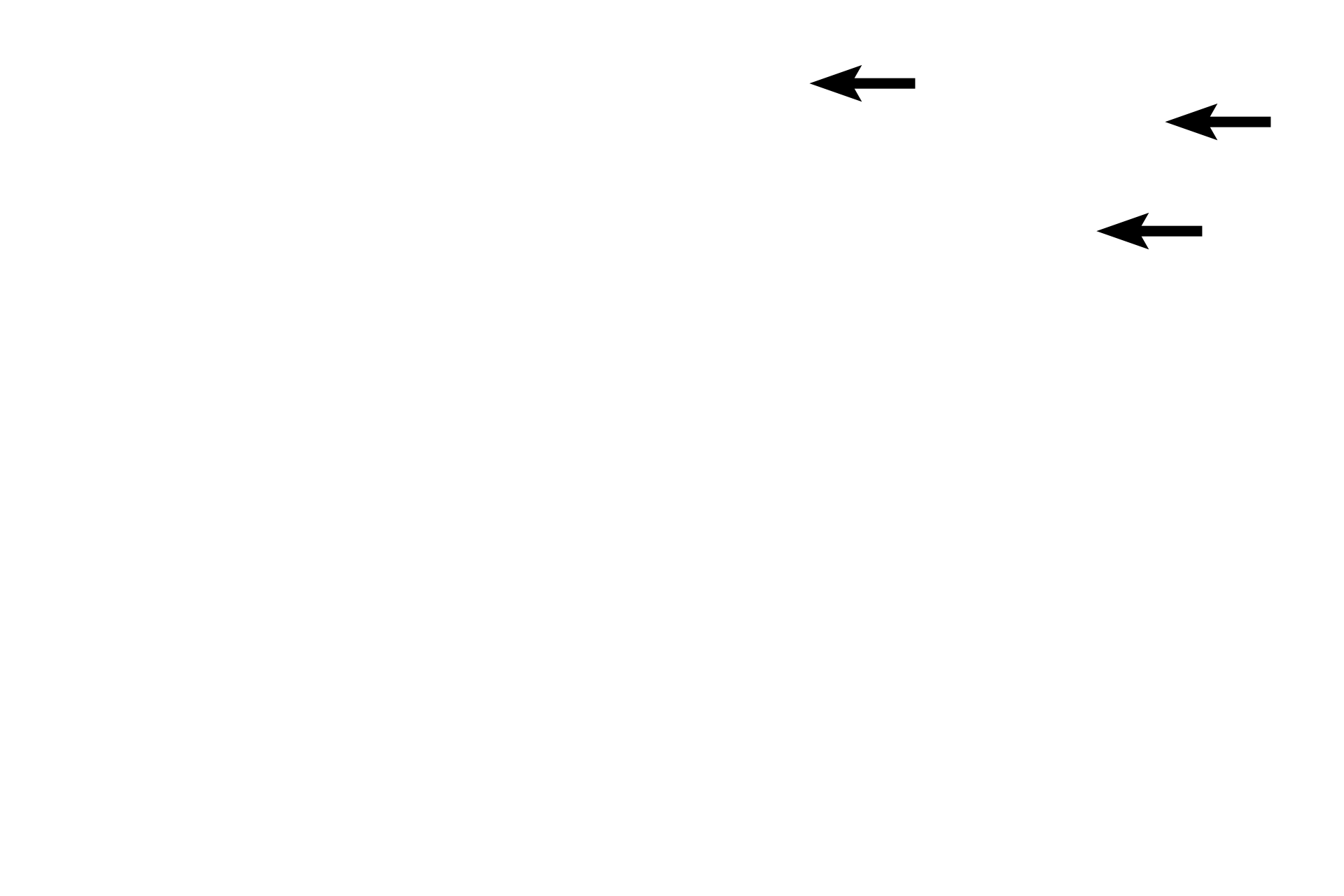  - Fibroblasts <p>In dense connective tissue, fibroblast nuclei are oval to flattened and their cytoplasmic extensions are difficult to discern from the surrounding collagen fibers. Collagen fibers are highly interlaced.</p>
