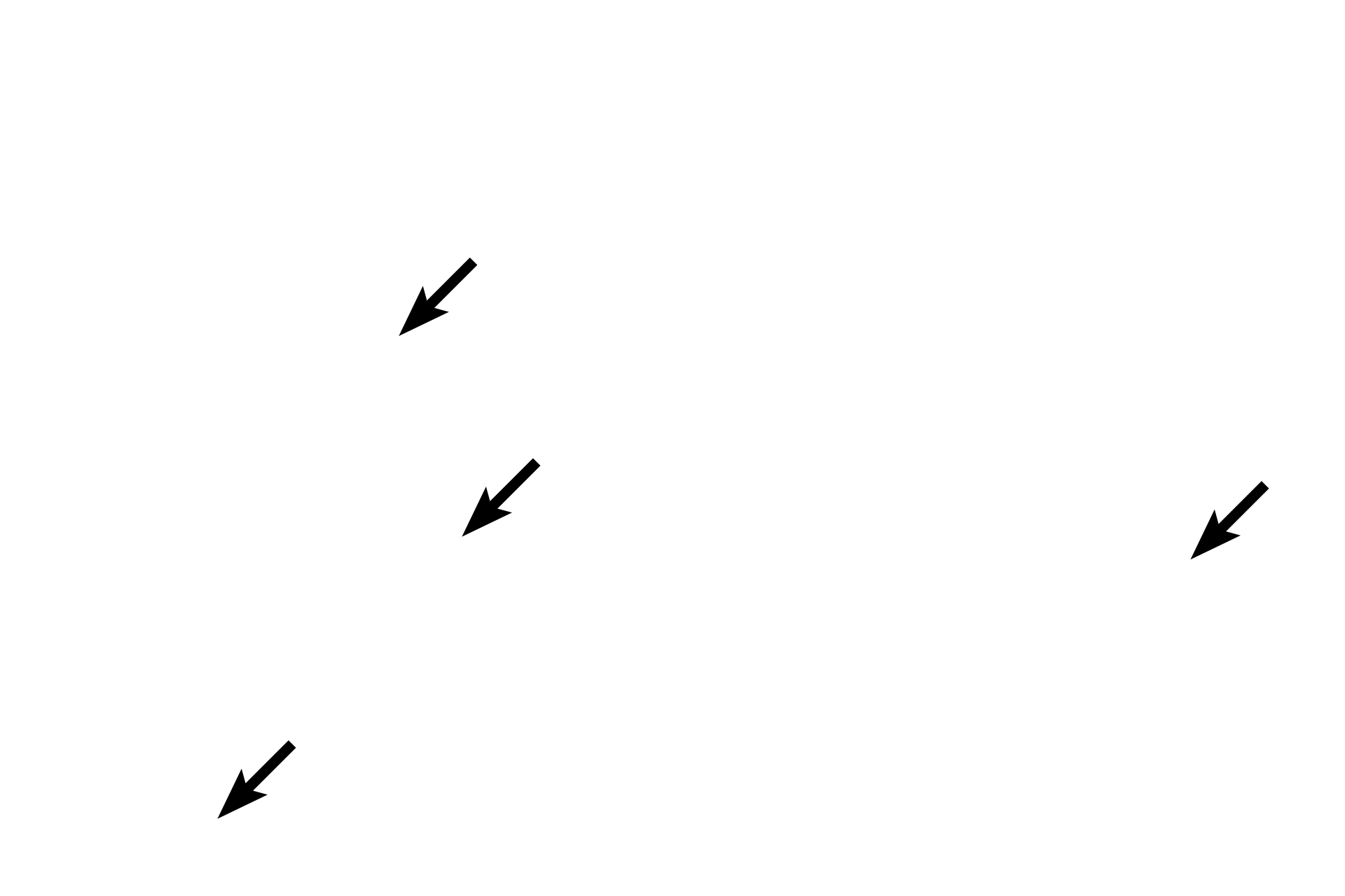  - Chondrocytes <p>In fibrocartilage, chondrocytes are protected from compression by the rubbery cartilage ground substance. Therefore, these cells display rounder nuclei and visible, basophilic cytoplasm. Collagen fibers extend between the chondrocytes and tend to run more parallel to each other than in dense irregular connective tissue.</p>
