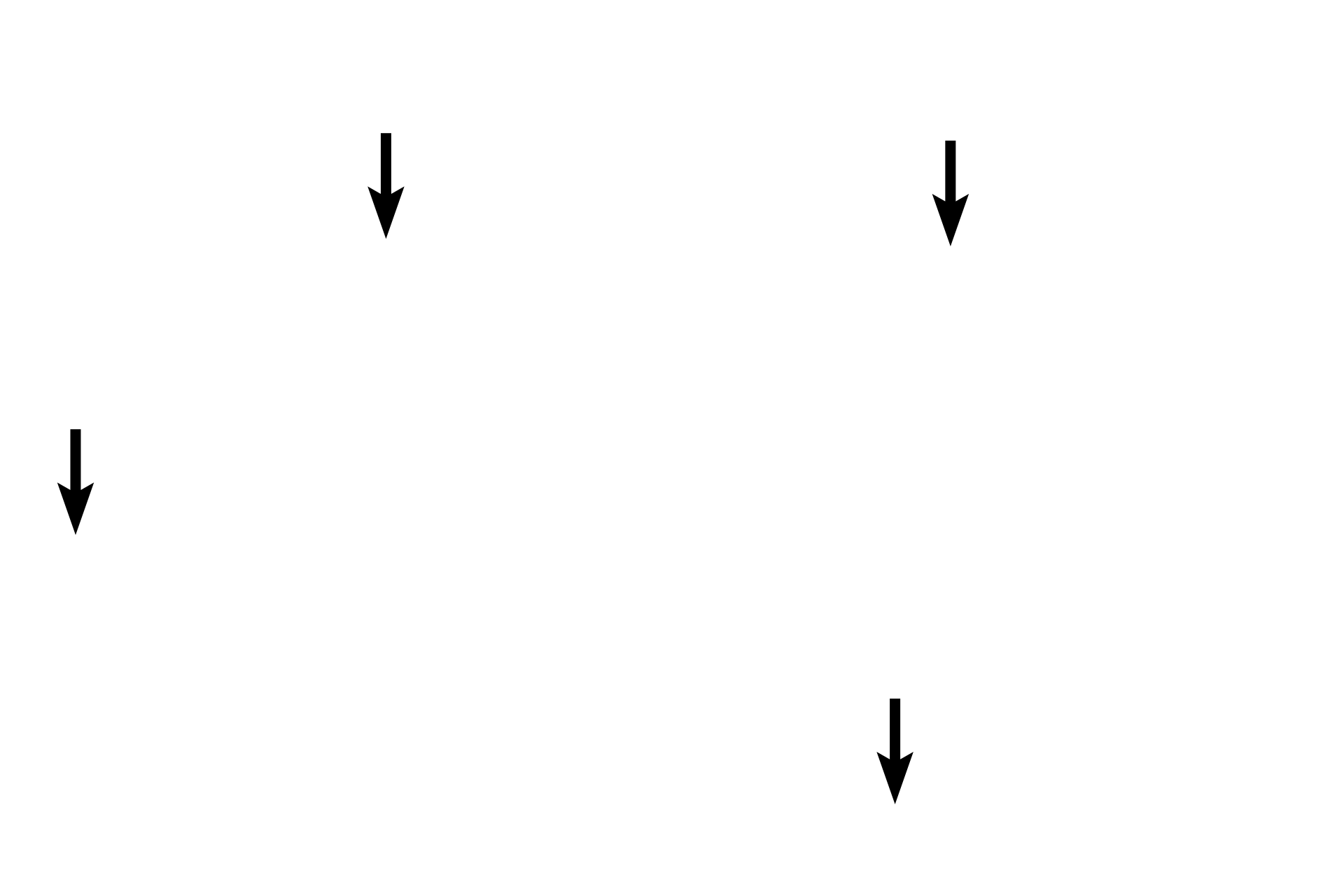 Collagen fibers <p>In fibrocartilage, chondrocytes are protected from compression by the rubbery cartilage ground substance. Therefore, these cells display rounder nuclei and visible, basophilic cytoplasm. Collagen fibers extend between the chondrocytes and tend to run more parallel to each other than in dense irregular connective tissue.</p>
