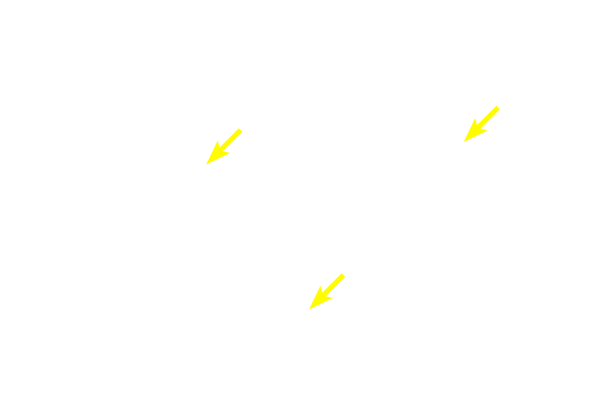  - Nuclei <p>Spherical cells can also be found in tissues.  This image shows dorsal root ganglion (DRG) neurons, which are highly specialized to conduct sensory signals into the brain and spinal cord.  Each cell possesses a well-defined nucleus and nucleolus. DRG neurons are surrounded by small supporting cells (Schwann cells).  Dorsal root ganglion  1000x</p>
