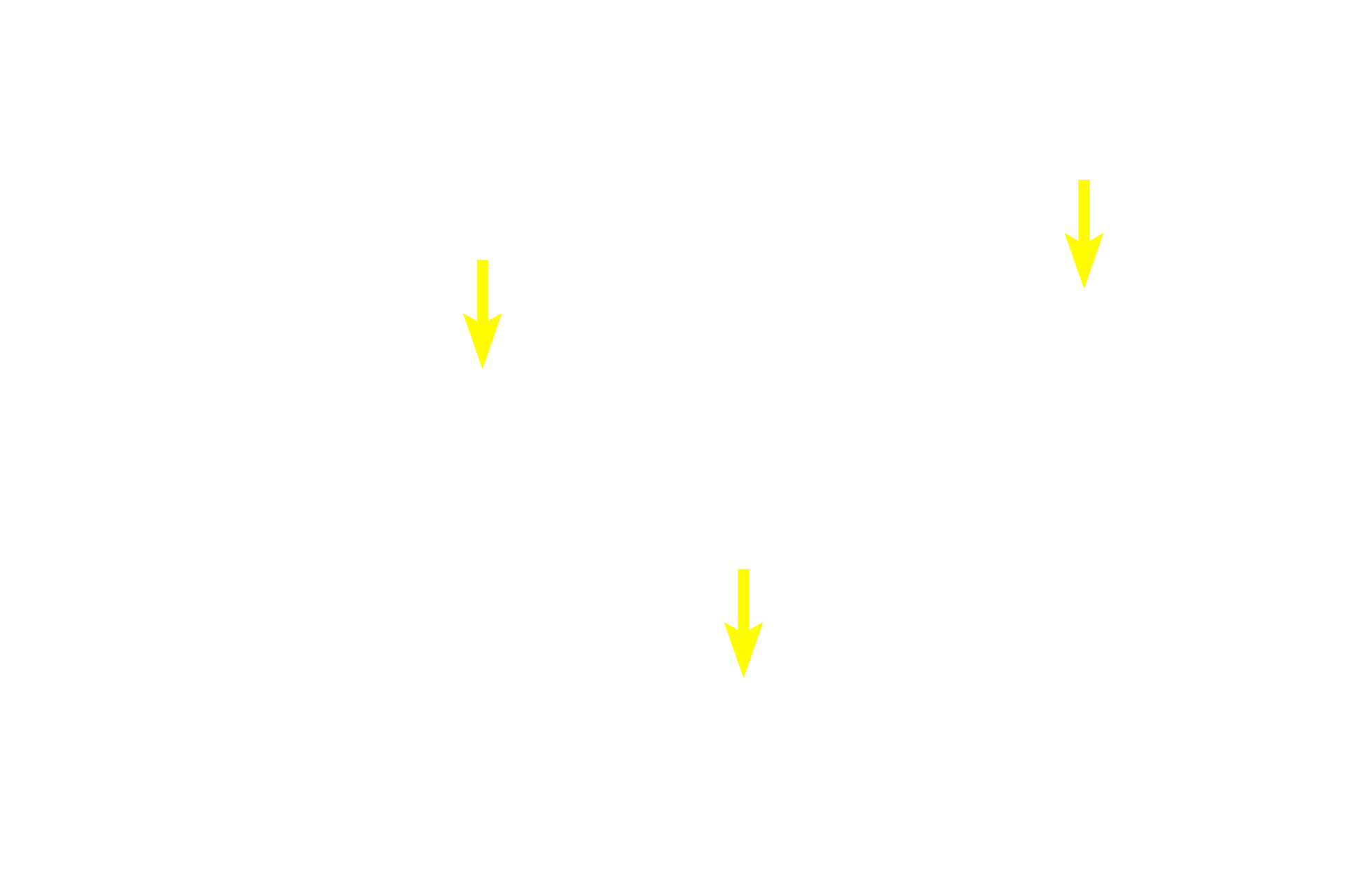  - Cytoplasm <p>Spherical cells can also be found in tissues.  This image shows dorsal root ganglion (DRG) neurons, which are highly specialized to conduct sensory signals into the brain and spinal cord.  Each cell possesses a well-defined nucleus and nucleolus. DRG neurons are surrounded by small supporting cells (Schwann cells).  Dorsal root ganglion  1000x</p>

