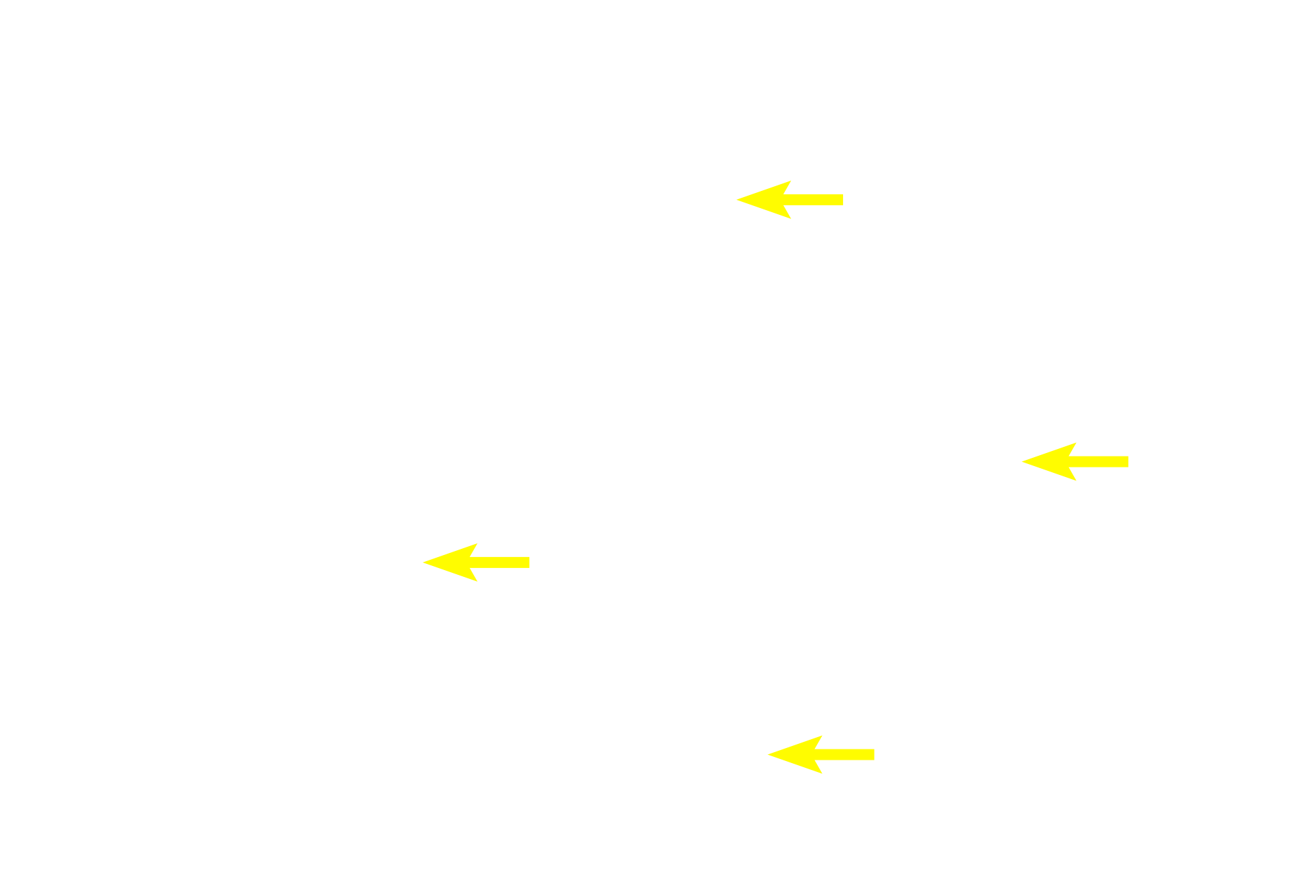 Supporting cells <p>Spherical cells can also be found in tissues.  This image shows dorsal root ganglion (DRG) neurons, which are highly specialized to conduct sensory signals into the brain and spinal cord.  Each cell possesses a well-defined nucleus and nucleolus. DRG neurons are surrounded by small supporting cells (Schwann cells).  Dorsal root ganglion  1000x</p>
