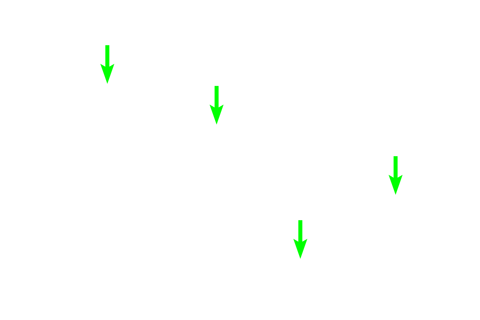 Elastic sheets <p>Elastin stains, such as Verhoeff’s-van Gieson, are used specifically to reveal elastin, a major protein component of elastic fibers and sheets. The specificity of the stain is due to the unique chemical properties of elastin and results in elastin staining a black or brown color. In this image of an elastic artery, sheets of elastic tissue alternate with layers of smooth muscle cells. Elastic artery 400x </p>
