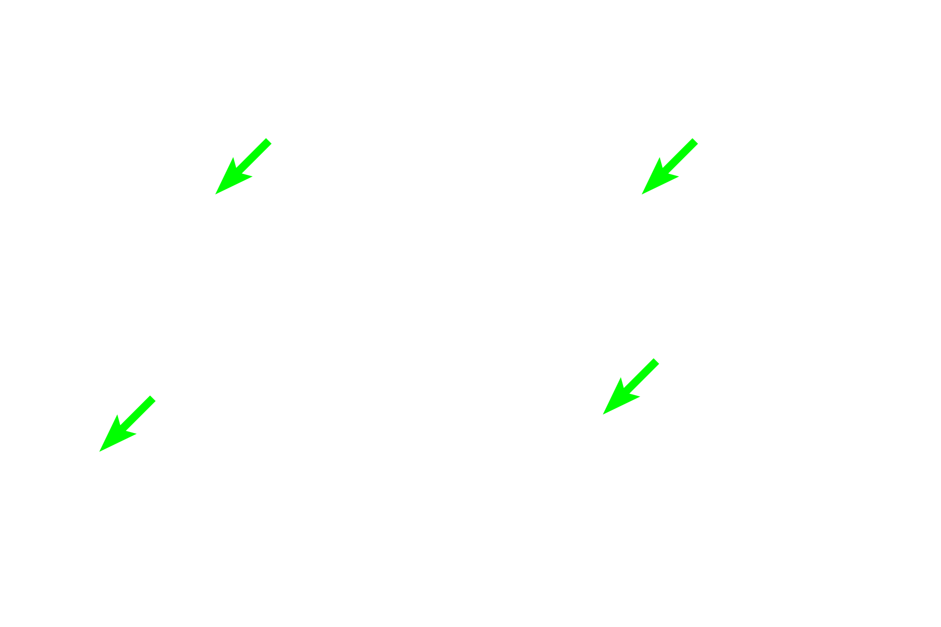 Smooth muscle cells <p>Elastin stains, such as Verhoeff’s-van Gieson, are used specifically to reveal elastin, a major protein component of elastic fibers and sheets. The specificity of the stain is due to the unique chemical properties of elastin and results in elastin staining a black or brown color. In this image of an elastic artery, sheets of elastic tissue alternate with layers of smooth muscle cells. Elastic artery 400x </p>
