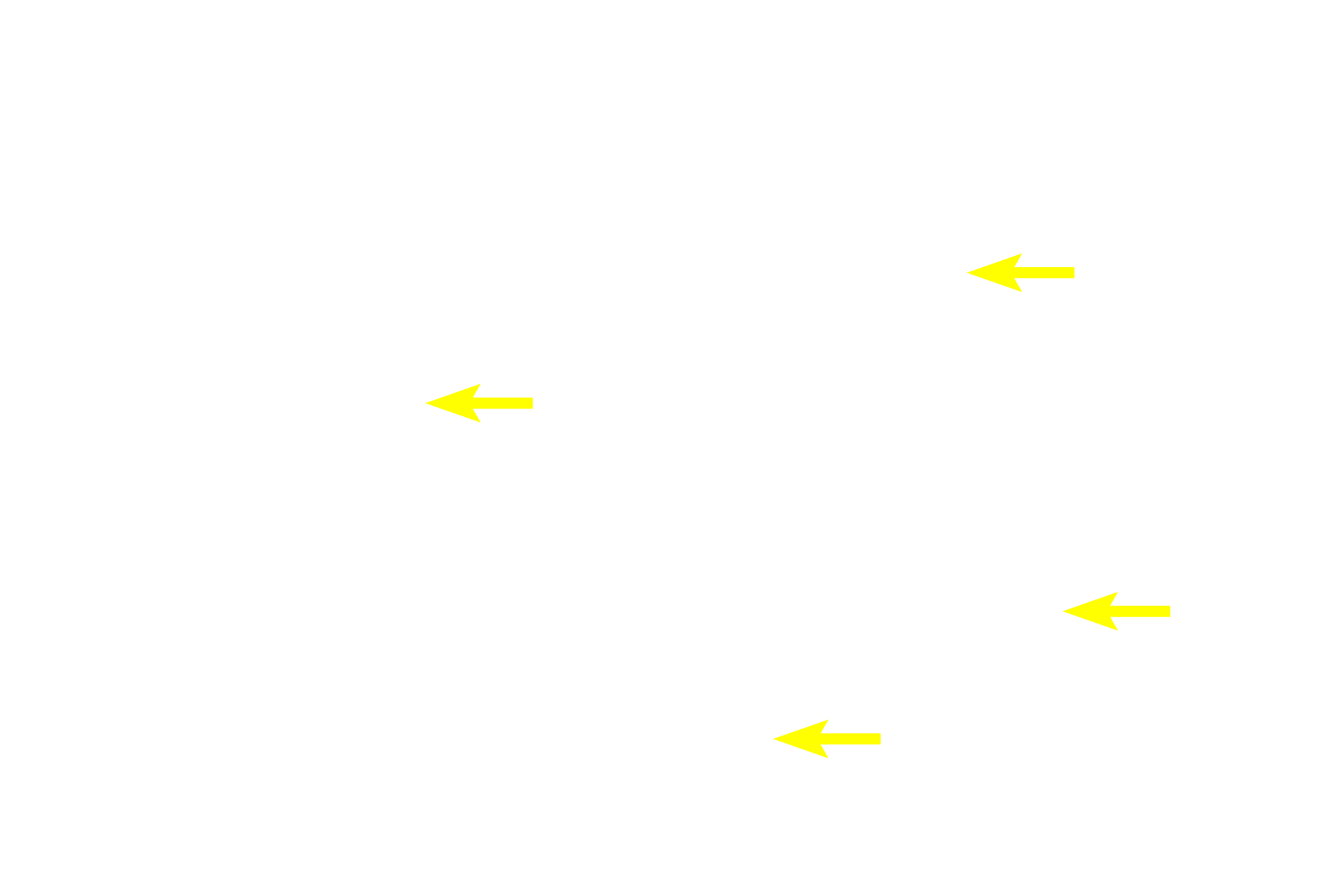 Euchromatic nuclei <p>Chromatin is a complex of protein and DNA.  The staining characteristic of chromatin indicates the level of transcriptional activity in the cell.  These light micrographs contrast euchromatin, which is pale-staining and transcriptionally active, with heteochromatin, which is dark staining and transcriptionally less active.  Neuron (L)  1000x; Thymus (R)  400x</p>
