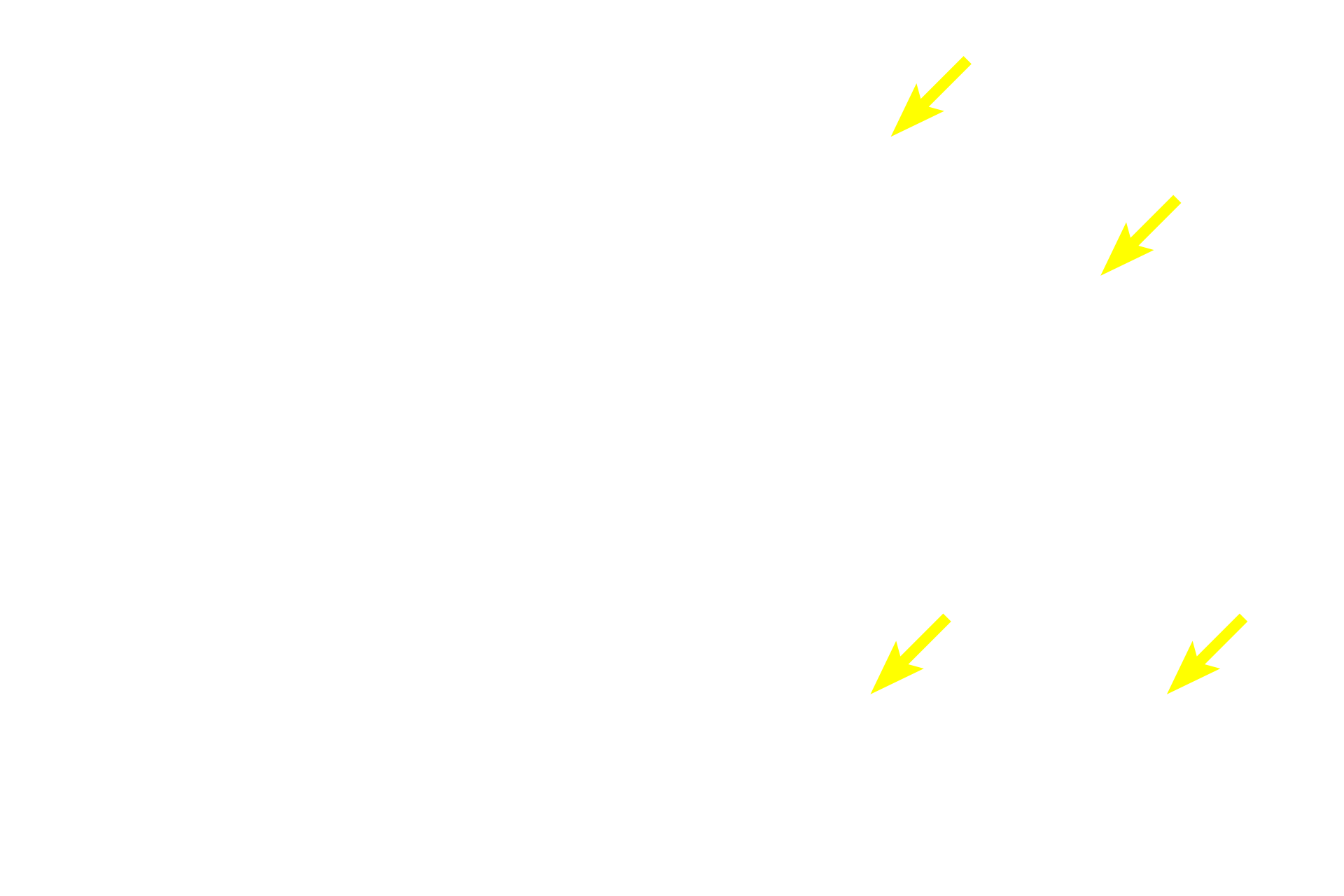 Heterochromatic nuclei <p>Chromatin is a complex of protein and DNA.  The staining characteristic of chromatin indicates the level of transcriptional activity in the cell.  These light micrographs contrast euchromatin, which is pale-staining and transcriptionally active, with heteochromatin, which is dark staining and transcriptionally less active.  Neuron (L)  1000x; Thymus (R)  400x</p>
