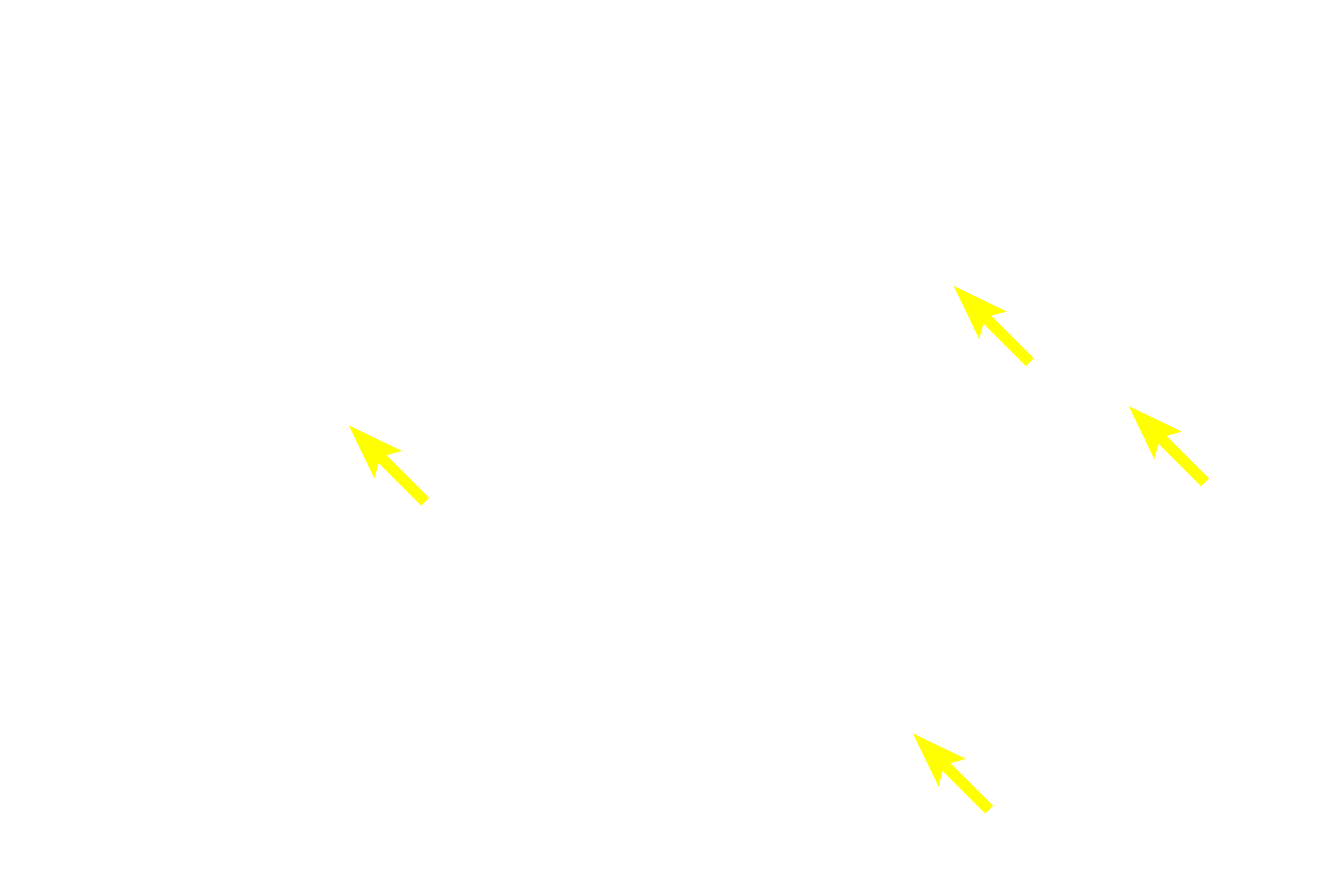 Nucleoli <p>Chromatin is a complex of protein and DNA.  The staining characteristic of chromatin indicates the level of transcriptional activity in the cell.  These light micrographs contrast euchromatin, which is pale-staining and transcriptionally active, with heteochromatin, which is dark staining and transcriptionally less active.  Neuron (L)  1000x; Thymus (R)  400x</p>

