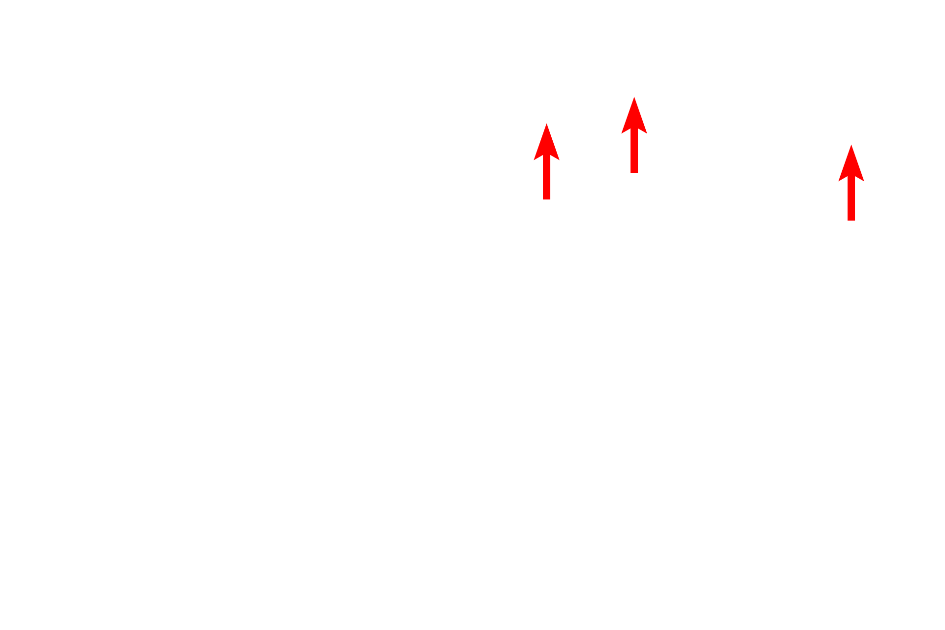 - Sebaceous glands <p>Thin skin covers the auricle and though not well shown here, is thicker posteriorly than anteriorly. Fine hairs are present on both surfaces. With aging, especially in men, large stiff hairs may develop around the entrance to the auditory meatus and at the posterior edge of the auricle. Sebaceous glands associated with hair follicles may be of considerable size.</p>

