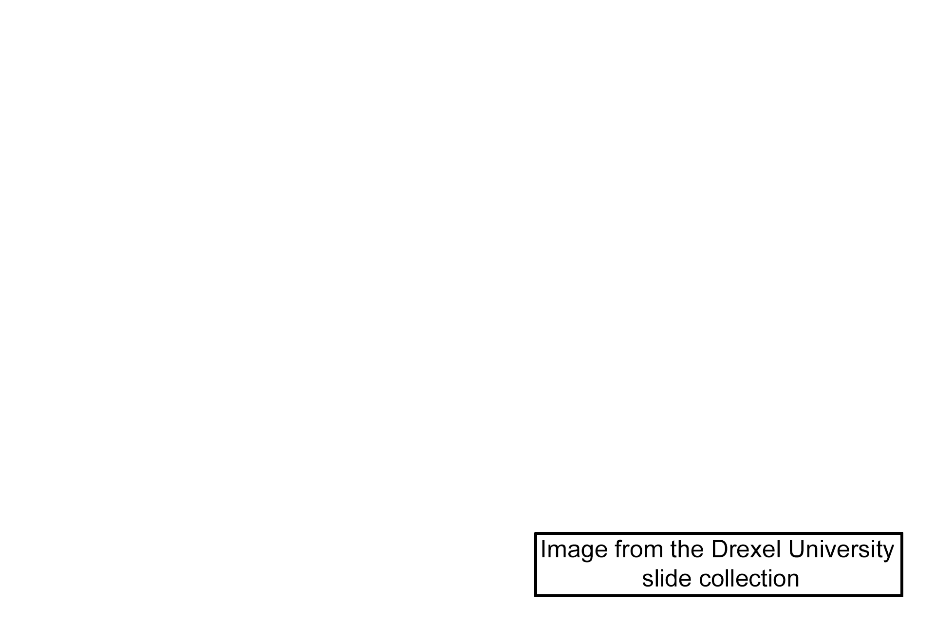 Image source > <p>This image was taken of a slide in the Drexel University collection.</p>
