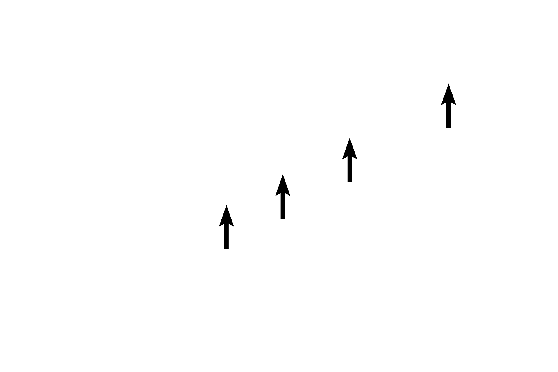  - Hair cells > <p>Each macula contains hair cells that possess stereocilia and a cilium, embedded in a gelatinous layer. Otoliths are suspended at the surface of the gel. Changes in gravity and linear motion displace the otoliths, which deflect the stereocilia and cilium, thereby initiating an impulse in CN VIII.</p>
