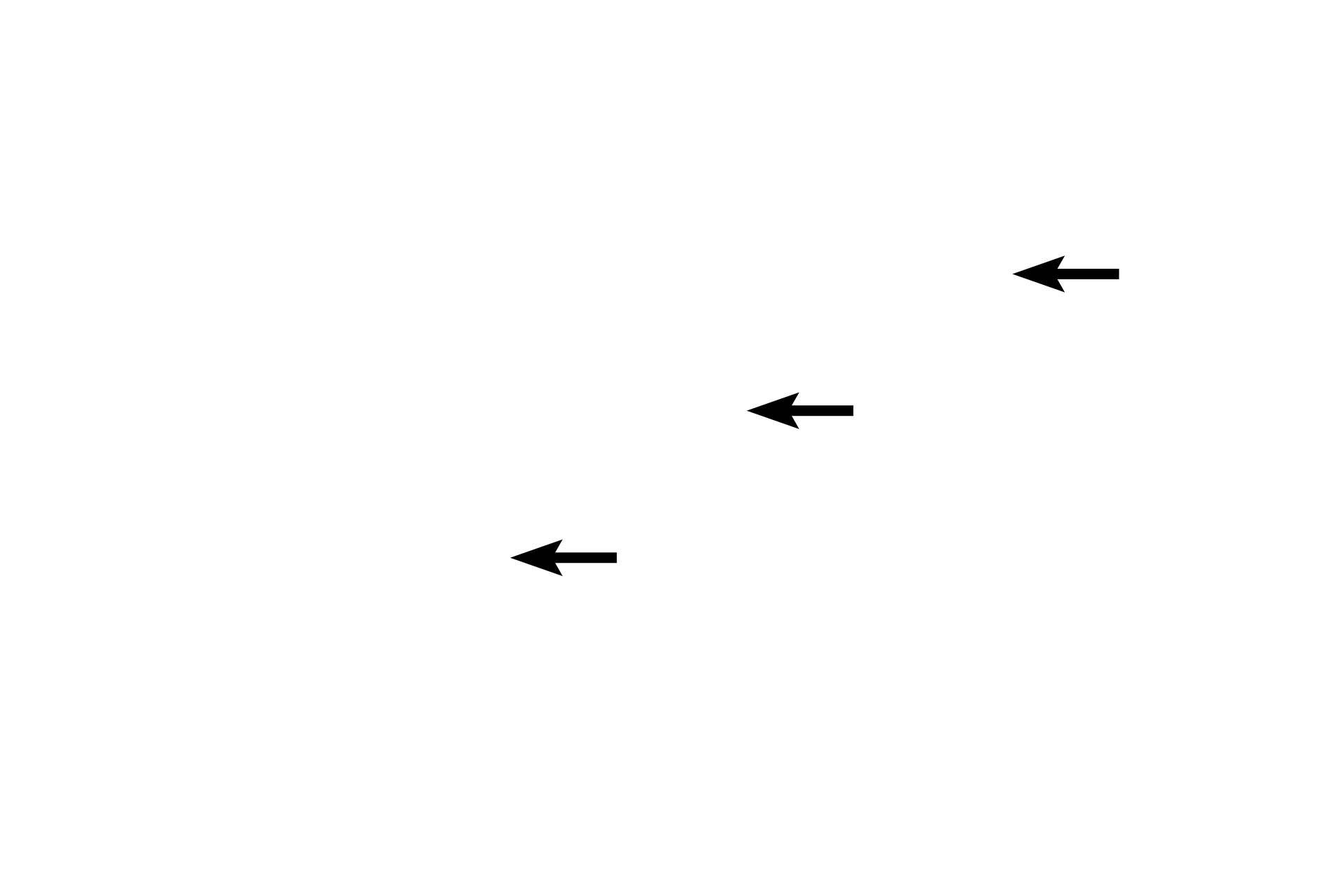 - Gel <p>Each macula contains hair cells that possess stereocilia and a cilium, embedded in a gelatinous layer. Otoliths are suspended at the surface of the gel. Changes in gravity and linear motion displace the otoliths, which deflect the stereocilia and cilium, thereby initiating an impulse in CN VIII.</p>

