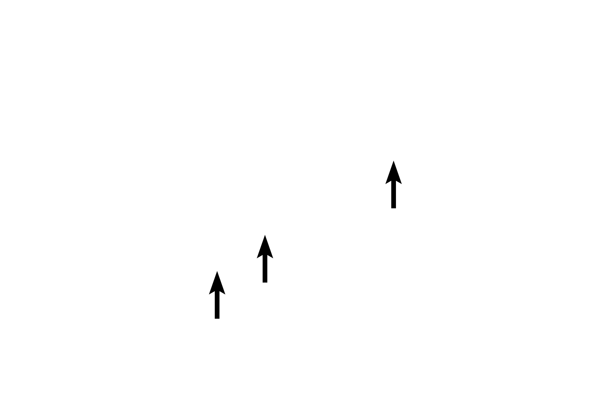  - Otoliths <p>Each macula contains hair cells that possess stereocilia and a cilium, embedded in a gelatinous layer. Otoliths are suspended at the surface of the gel. Changes in gravity and linear motion displace the otoliths, which deflect the stereocilia and cilium, thereby initiating an impulse in CN VIII.</p>

