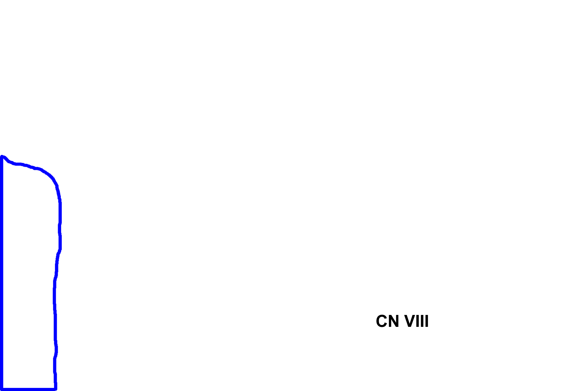 Ganglion of CN VIII <p>The sensory cell bodies of the neurons  supplying the maculae and cristae ampullares are located adjacent to these receptors. These neurons are part of the vestibular division of the vestibulocochlear nerve, CN VIII.</p>
