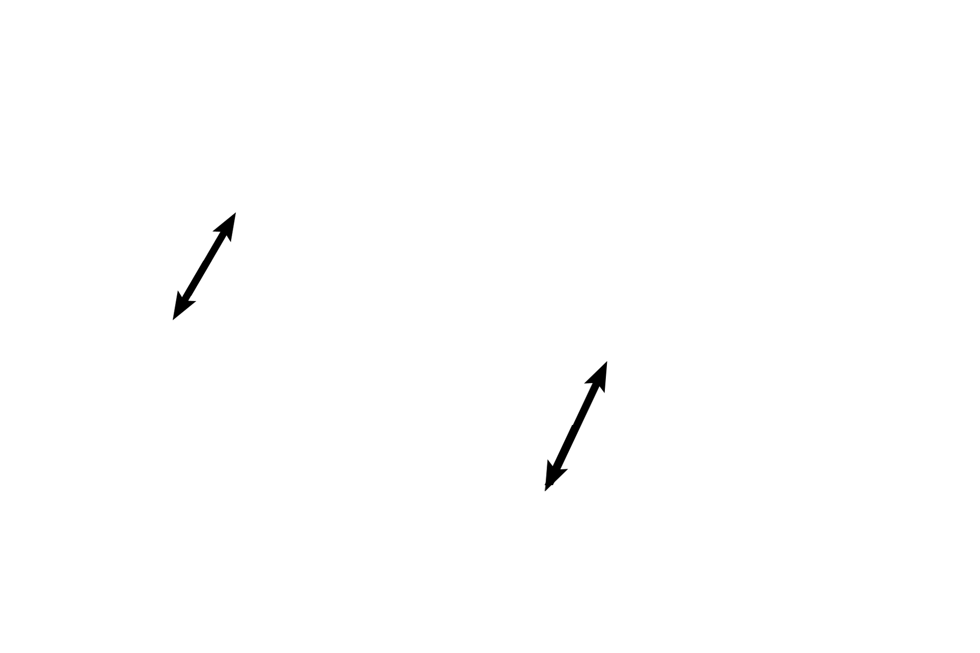 Tunica albuginea <p>The ovary is covered by a serosa of epithelium overlying a thin connective tissue layer. However, rather than the expected simple squamous epithelium, the epithelium of this serosa is simple cuboidal and is called by the misnomer “germinal epithelium.”  A dense connective tissue layer, tunica albuginea, lies beneath the serosa. Small follicles are located in the cortex beneath the tunica albuginea.  400x</p>
