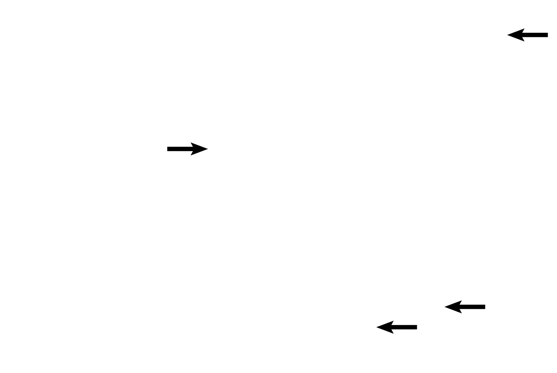Secretory cells <p>The oviductal mucosa is lined by simple columnar epithelium with cilia and unicellular glands.  Ciliated cells and their basal bodies are well demonstrated.  Secretory cells (peg cells) lack cilia; their nutritive secretory product frequently protrudes into the lumen prior to release.  Lamina propria is the connective tissue layer of the mucosa, underlying the epithelium.  1000x </p>
