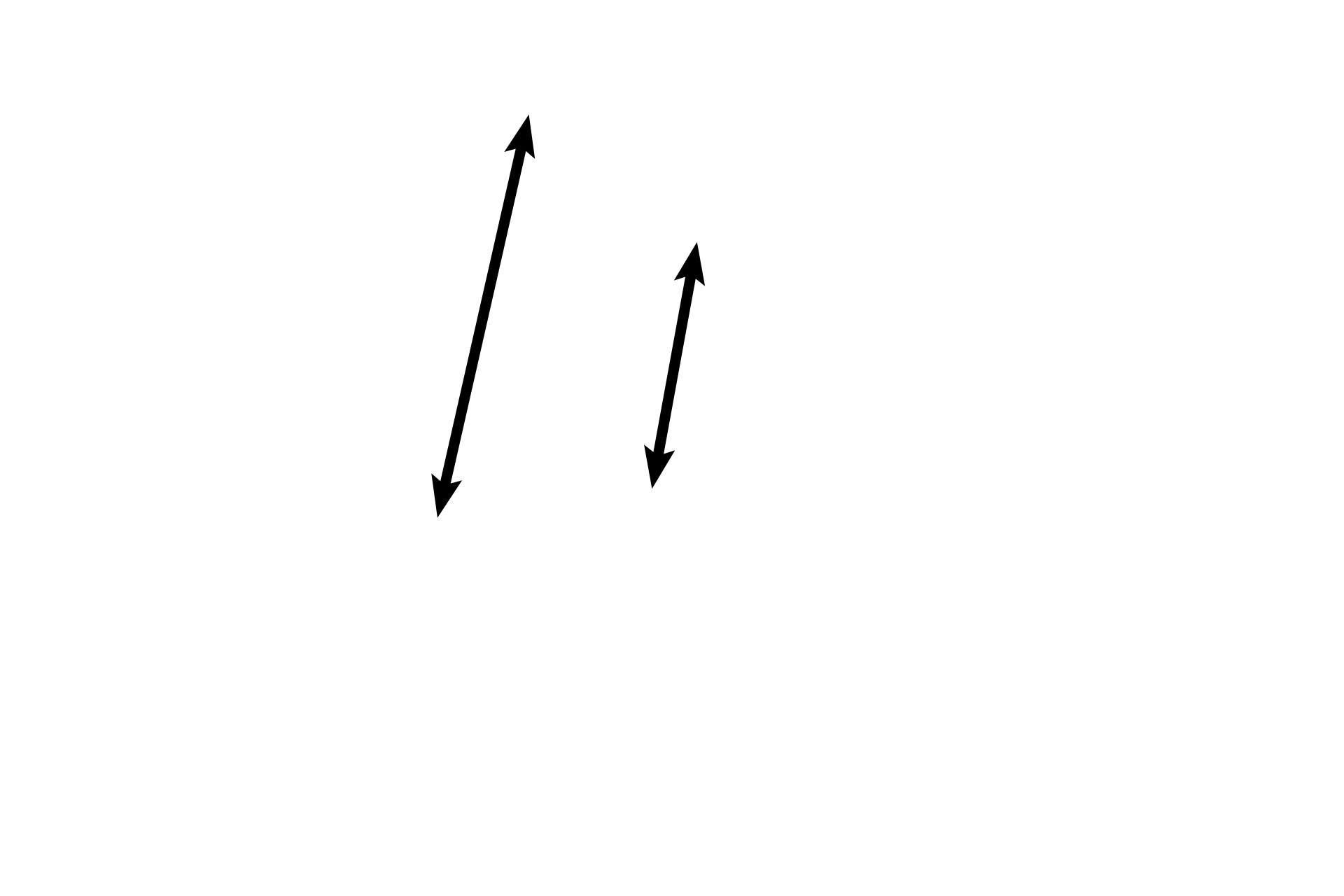 Theca lutein cells <p>This infolding near the periphery of the corpus luteum demonstrates its two cell types.  Both types possess organelles characteristic of all steroid producing cells, such as abundant SER and mitochondria with tubular cristae.  The expected vacuolation resulting from the storage of cholesterol precursors is not evident here.  1000x </p>
