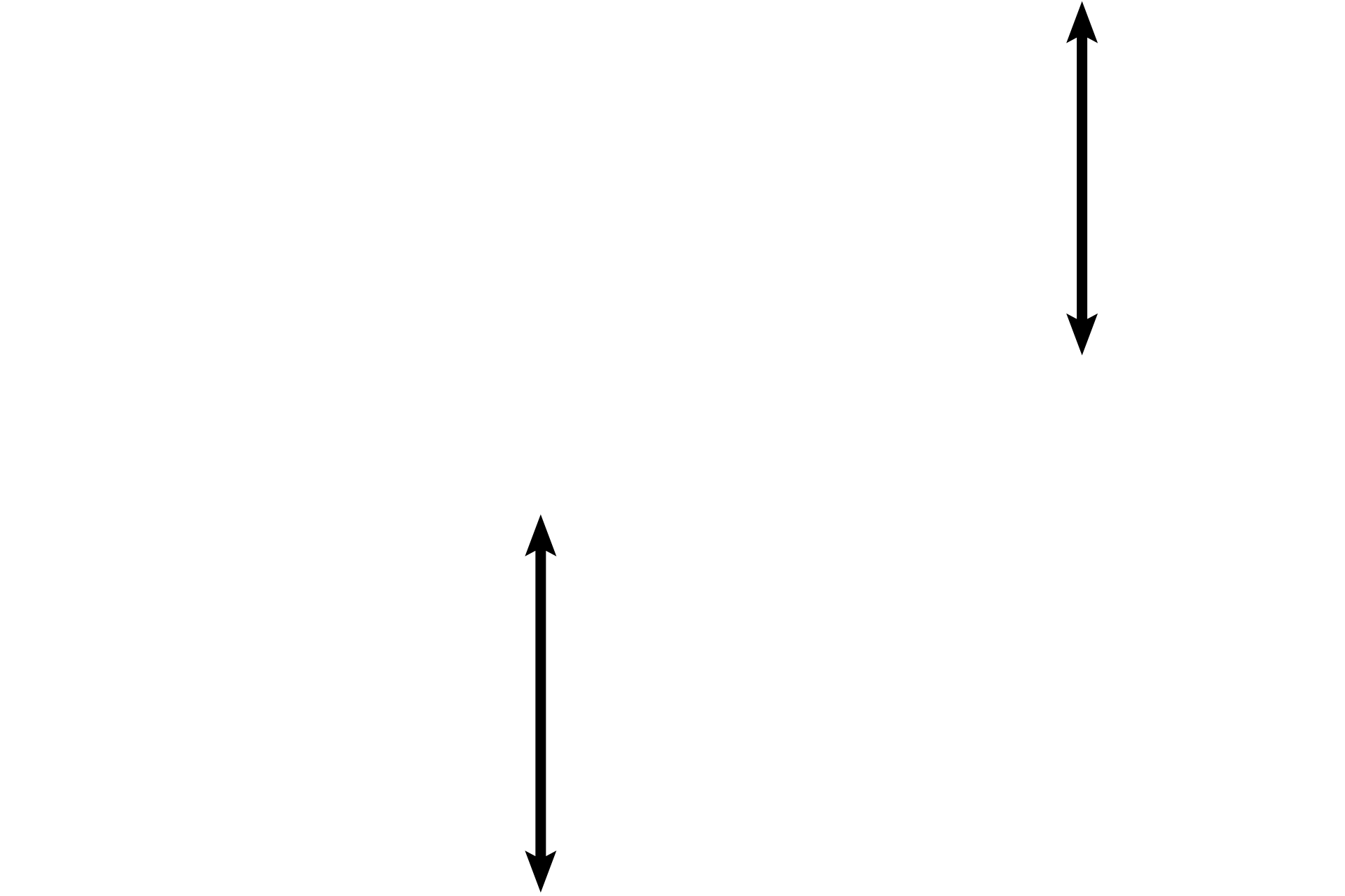 Granulosa lutein cells <p>This infolding near the periphery of the corpus luteum demonstrates its two cell types.  Both types possess organelles characteristic of all steroid producing cells, such as abundant SER and mitochondria with tubular cristae.  The expected vacuolation resulting from the storage of cholesterol precursors is not evident here.  1000x </p>
