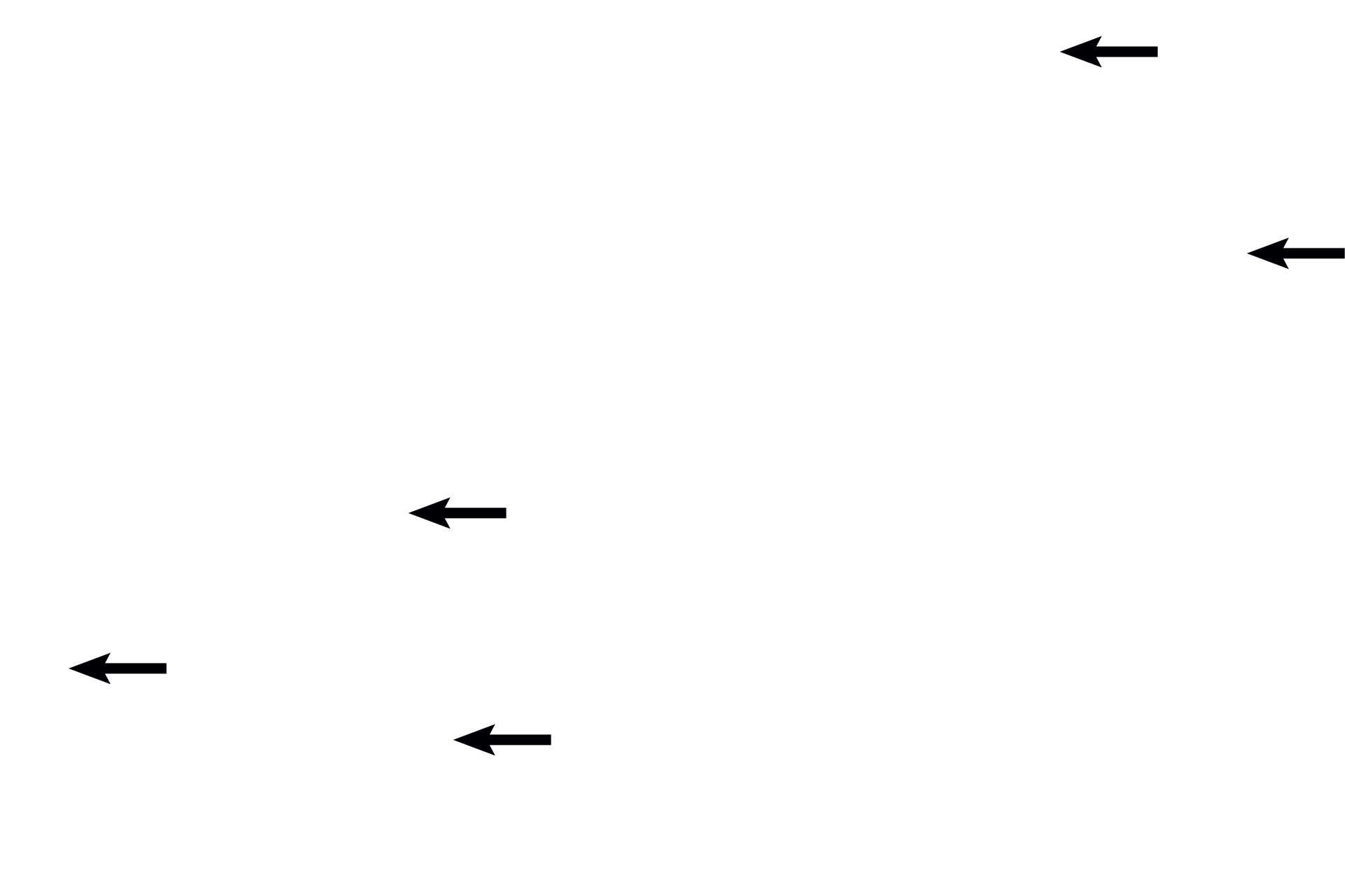  - Floating villi <p>Stem villi originate from the chorionic plate.  Numerous, branching villi, termed floating villi, extend from each stem villus into the intervillous space, where they are bathed by maternal blood.</p>
