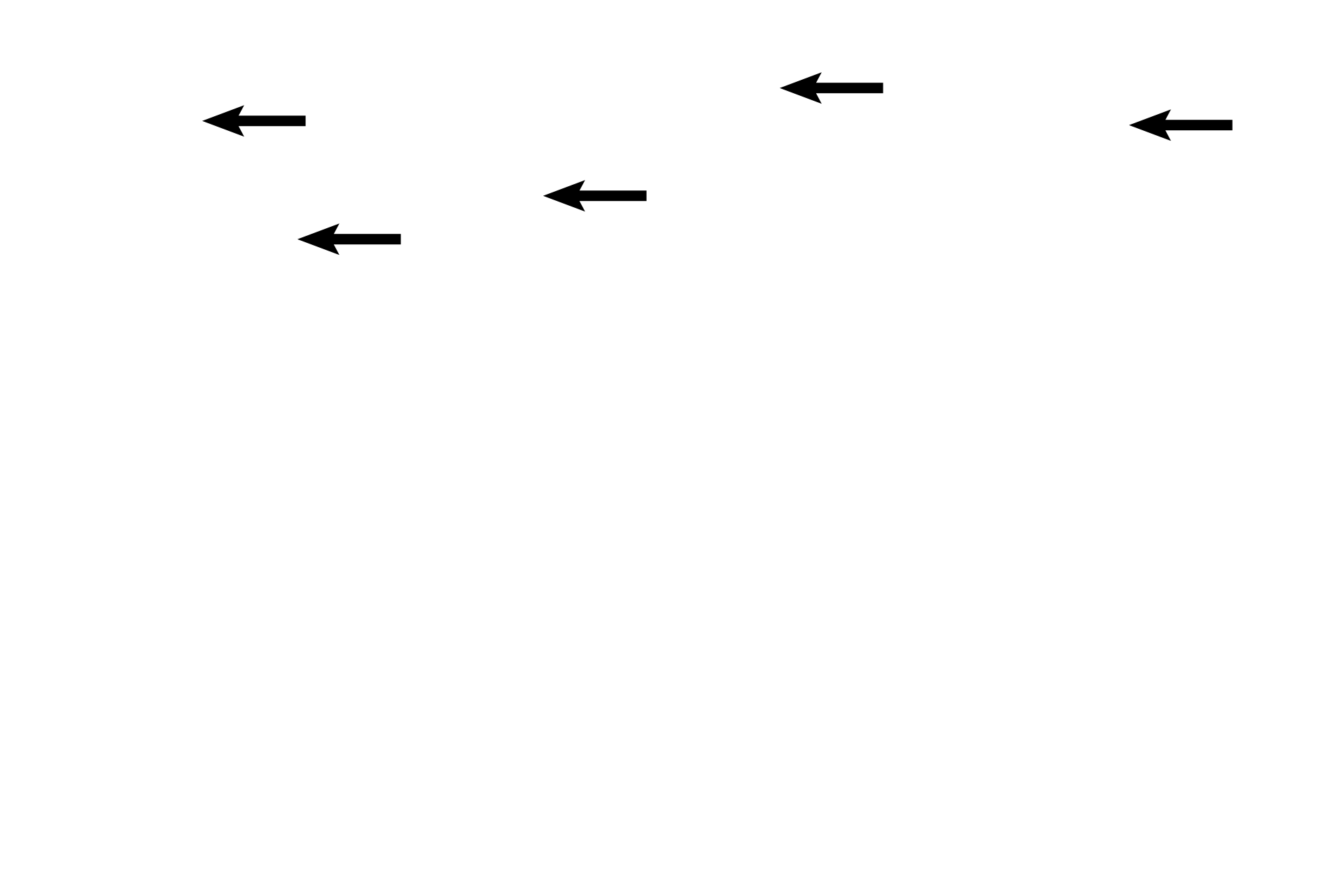 Predecidual cells <p>The sacculated glands show precipitated secretory product; areas of degeneration are obvious; extravasated blood is present in the stroma and predecidual cells can be seen beneath the surface of the organ.  The pre-menstrual phase is also known as the ischemic portion of the secretory phase.  40x </p>
