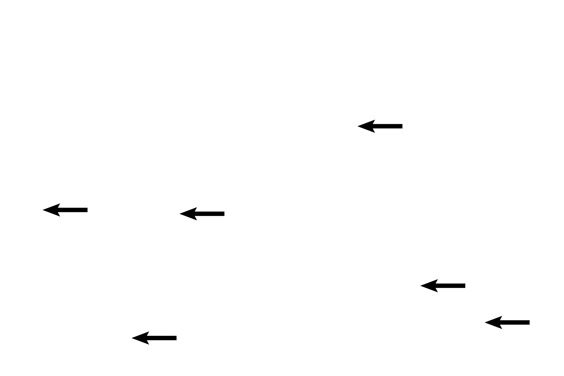 Glands <p>The sacculated glands show precipitated secretory product; areas of degeneration are obvious; extravasated blood is present in the stroma and predecidual cells can be seen beneath the surface of the organ.  The pre-menstrual phase is also known as the ischemic portion of the secretory phase.  40x </p>
