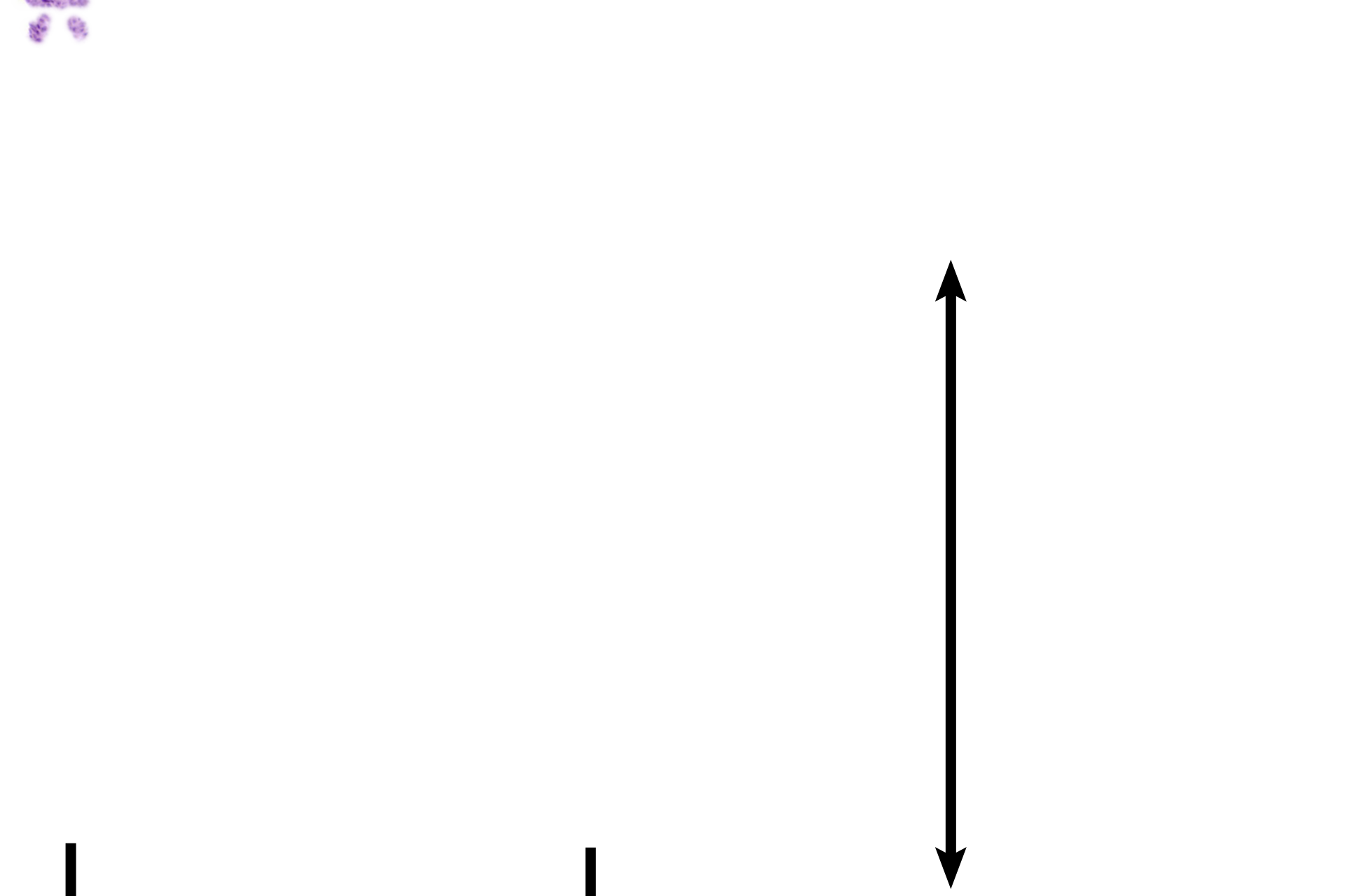 Myometrium  <p>Two images of the menstrual phase are shown.  The image on the left (at higher magnification) was taken earlier during the menstrual phase, while the one on the right is from the end of menses.  100x, 10x </p>
