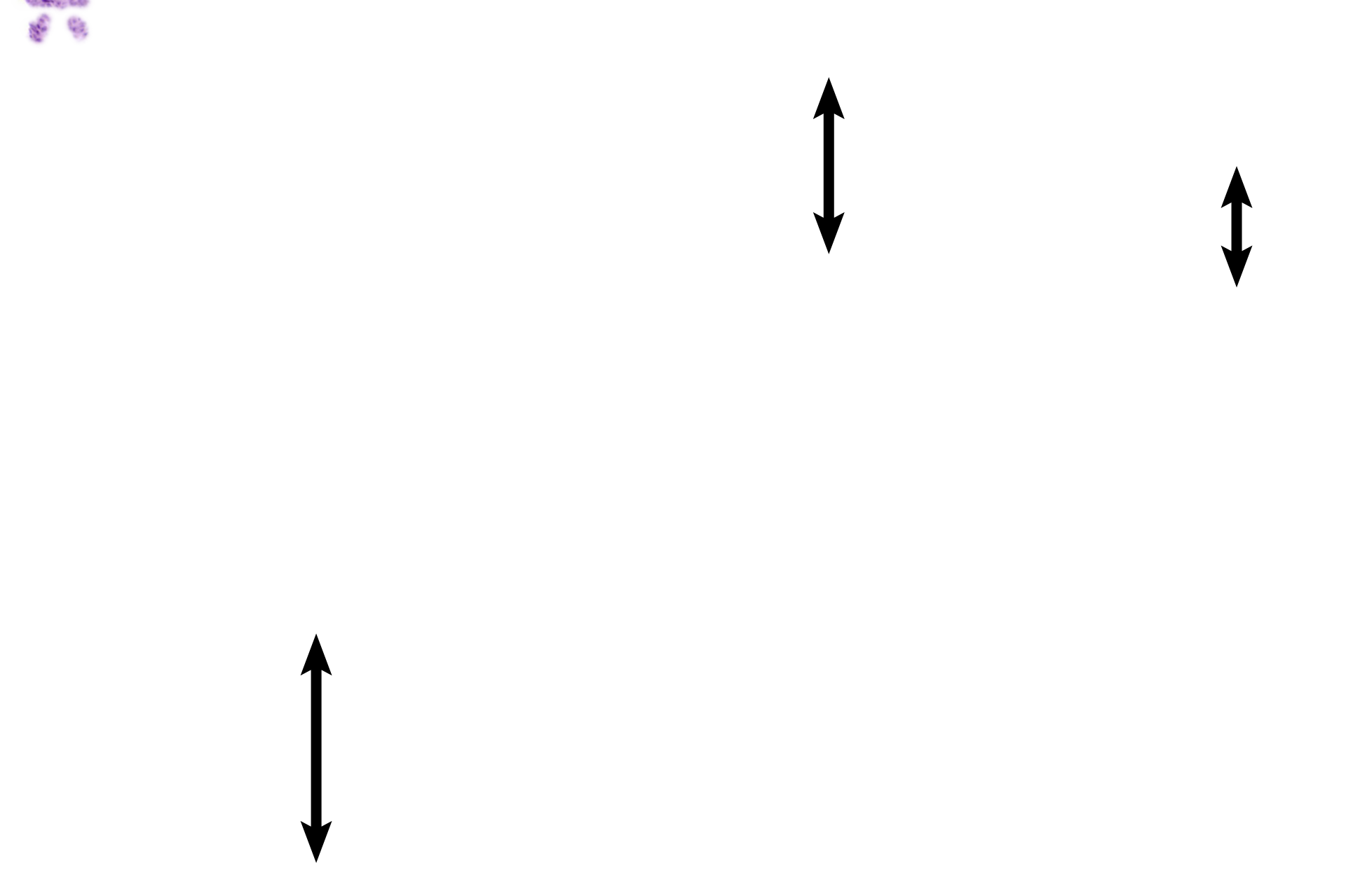 Basal zone   <p>The functional zone is in the process of being sloughed in the left image.  Note glands located at the luminal surface. The functional zone has been completely sloughed in the right-hand image, leaving only the basal zone behind. </p>
