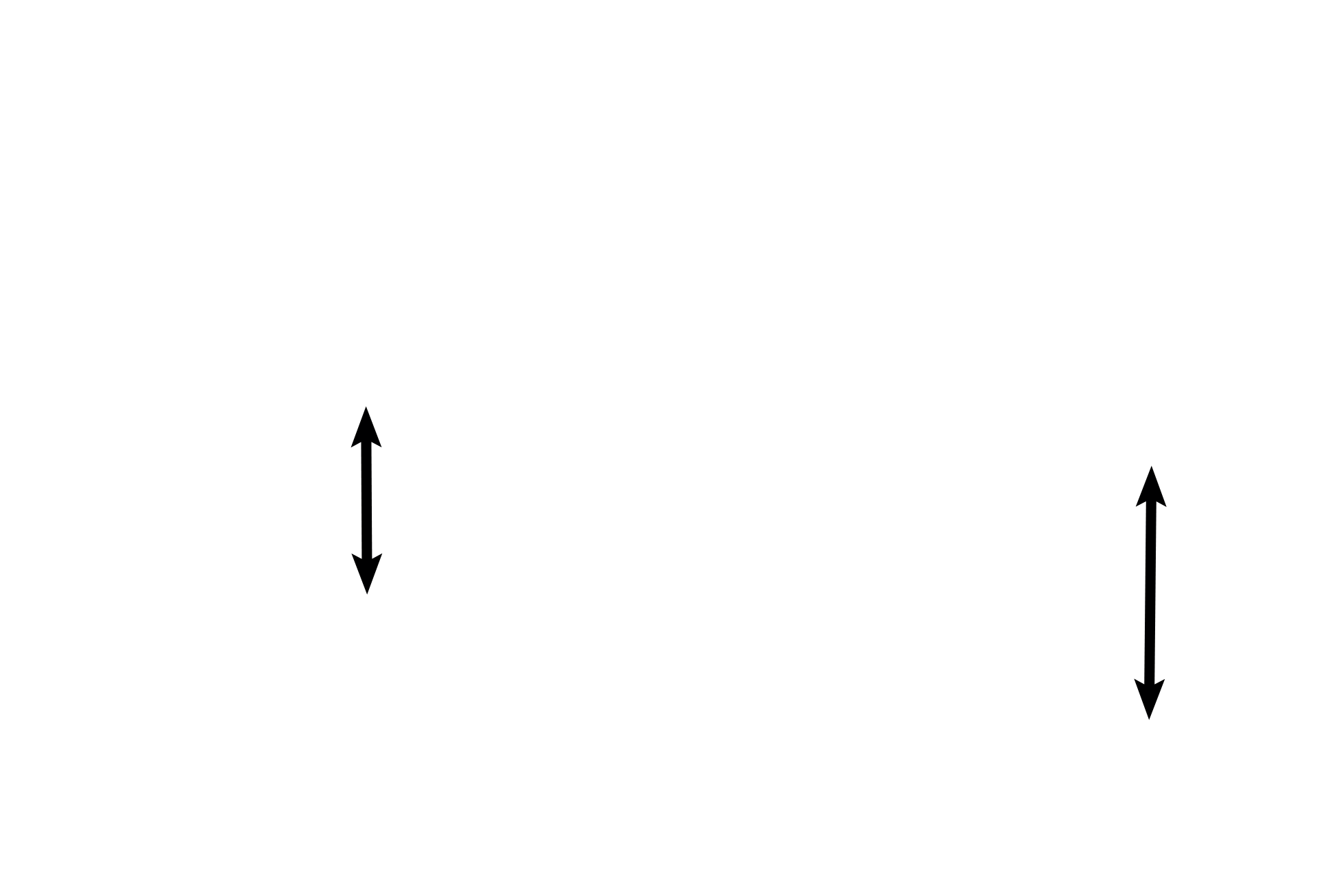 Muscularis externa  > <p>The muscularis externa is composed of irregularly arranged bundles of smooth muscle that are not arranged into inner circular and outer longitudinal layers.  An adventitia lies external to the muscularis externa. </p>
