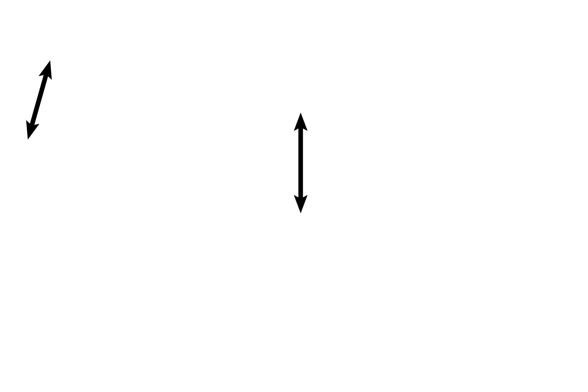 Stratified squamous moist epithelium <p>The mucosa of the vagina is composed of a stratified squamous moist epithelium that accumulates glycogen (under the influence of high estrogen at the time of ovulation) and a well vascularized lamina propria. The thin-walled veins in the connective tissue simulate erectile tissue during arousal. No glands are present in the vagina. 100x </p>
