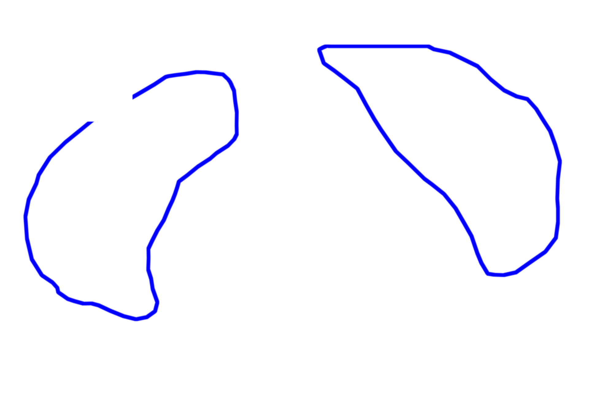 - Peripheral zone > <p>The peripheral zone occupies about 70% of the prostate volume and contains the main glands of the prostate and possess long ducts. The glands of the peripheral zone give rise to malignant tumors (adenocarcinomas) of the prostate.</p>
