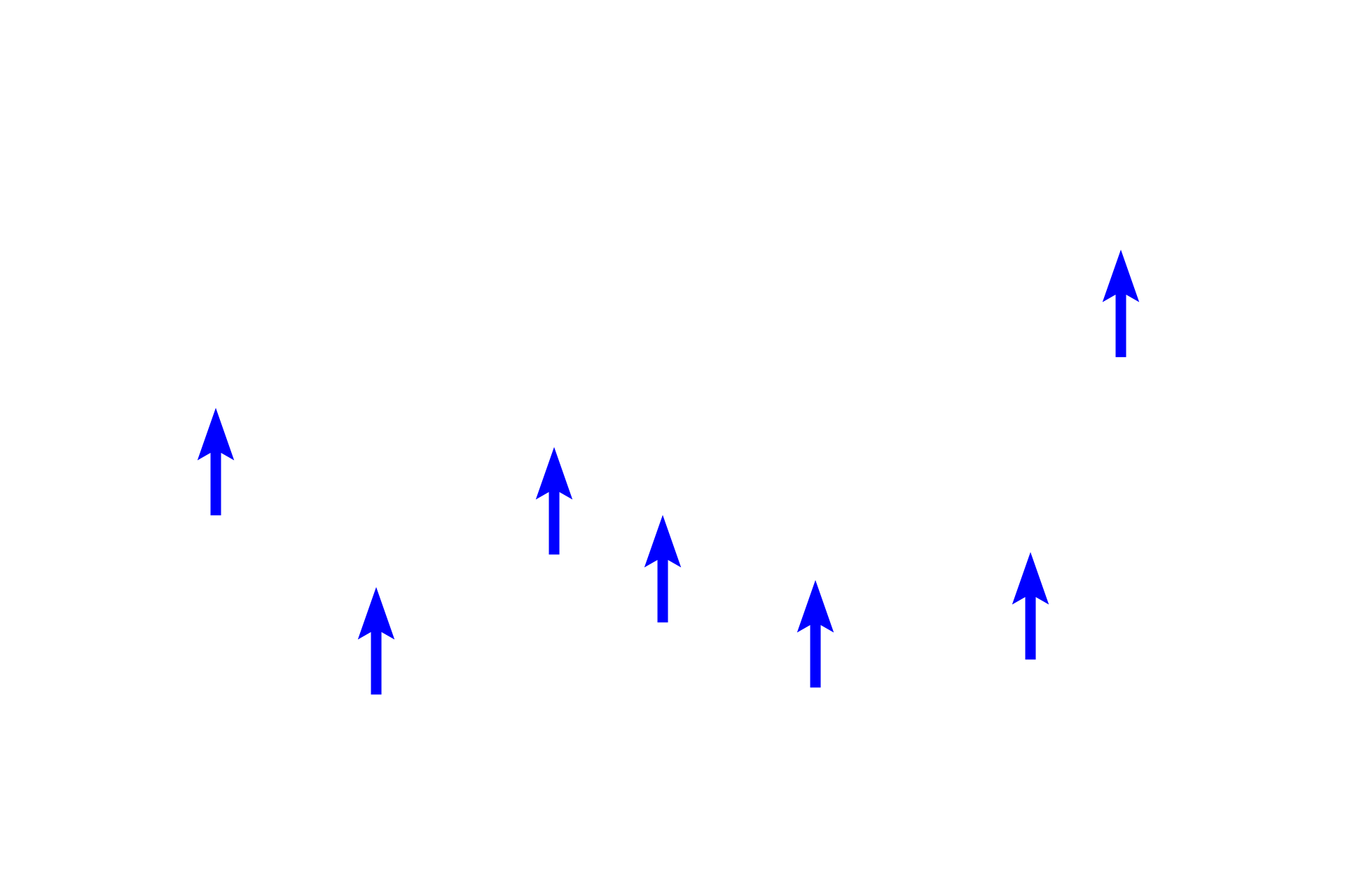 Prostatic glands > <p>Prostatic glands secrete a milky, slightly alkaline fluid containing citric acid, zinc, prostate-specific antigen (PSA) and fibrinolysin. The latter two are serine hydrolases that act to liquify the ejaculate in the vagina. The level of PSA in blood is used as a screening tool for prostate cancer. Prostatic glands are arranged in three roughly concentric zones around the prostatic urethra.</p>
