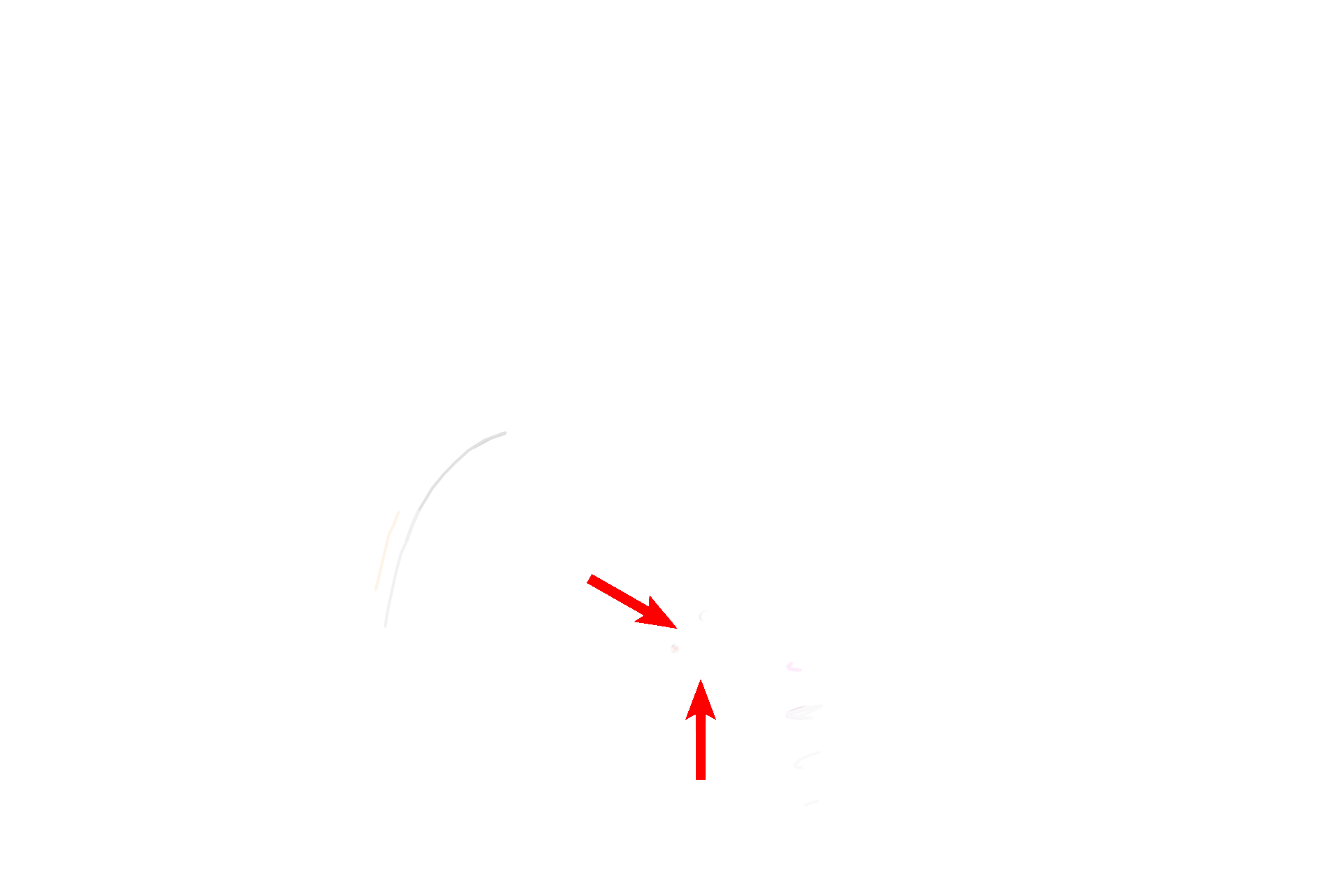  - Intratesticular ducts > <p>Sperm leaves the straight portions of the seminiferous tubules to enter the rete testis (red arrows) located in the mediastinum of the testis.</p>
