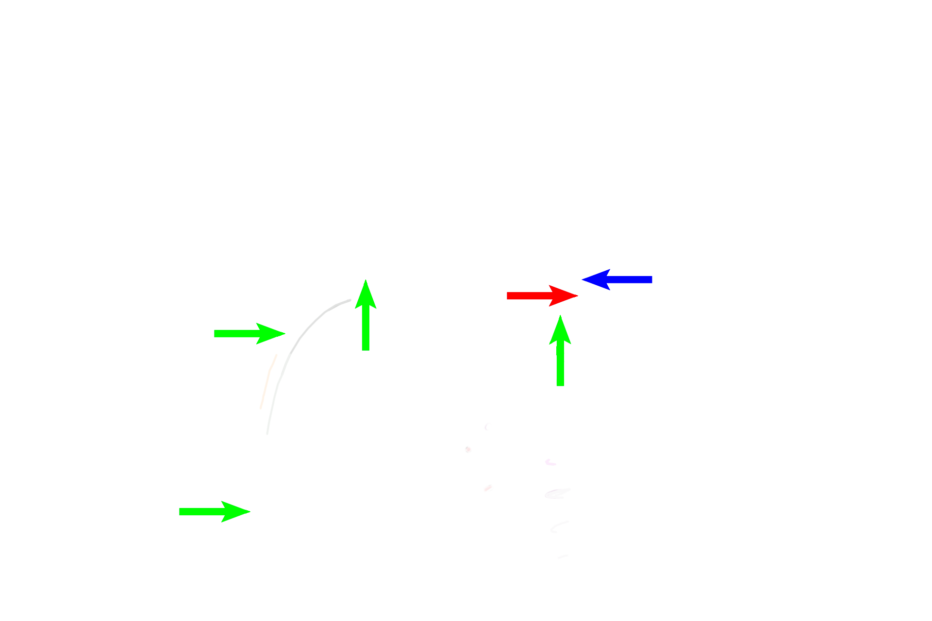  - Urethra > <p>The urethra carries urine but also transports sperm and seminal fluid during ejaculation. The portions of the urethra that transport the ejaculate are illustrated here. The prostatic urethra (blue arrow) is located in the prostate gland; the membranous urethra (red arrow) passes through the urogenital diaphragm; the penile urethra (green arrows) is located in corpus spongiosum of the penis.</p>
