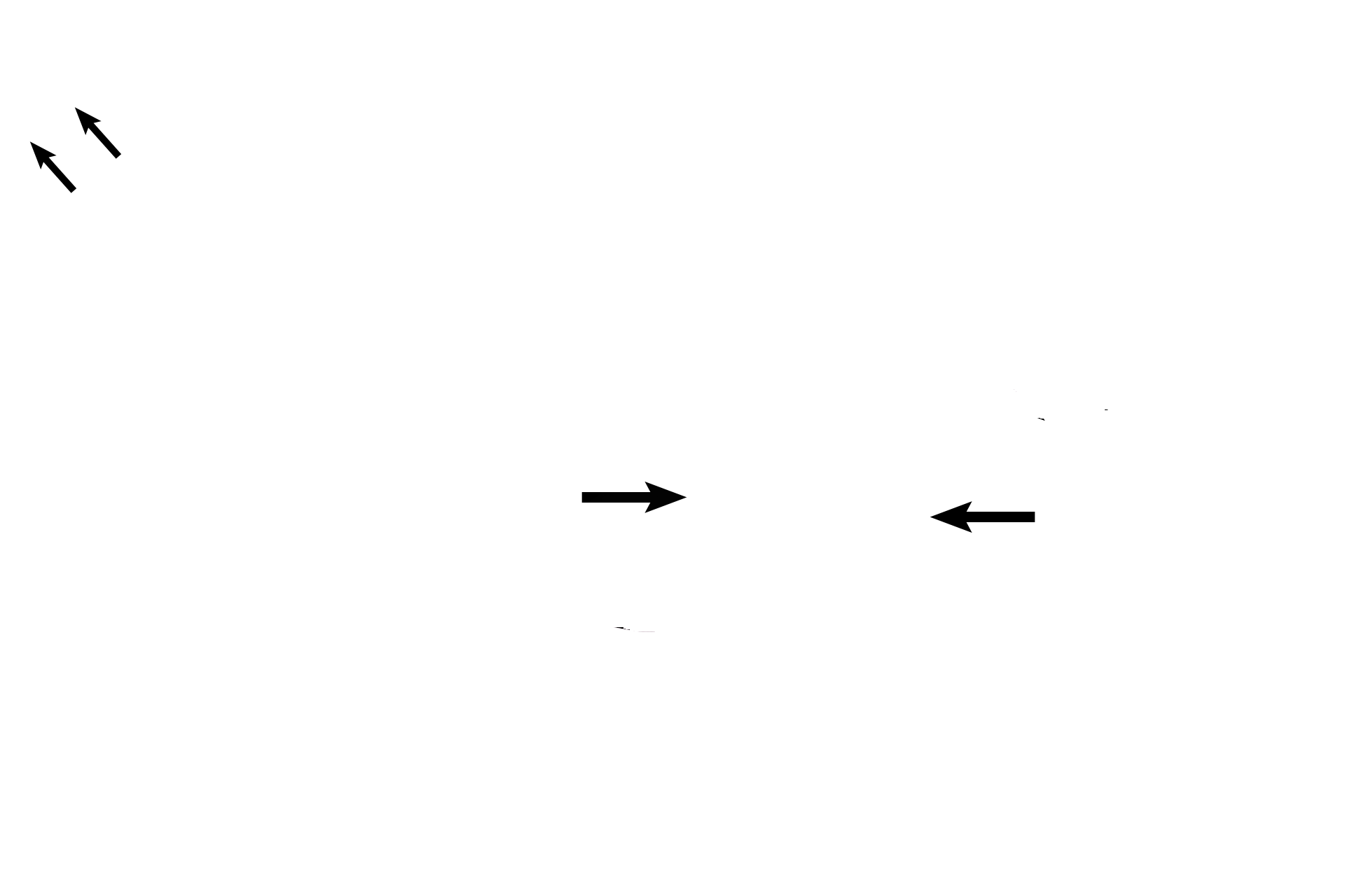  - Deep artery > <p>A deep artery supplies each corpus cavernosum.  Branches of the deep artery supply either the trabeculae of the corpus, via nutritive arteries during the flaccid state, or the venous channels (cavernous spaces), via helicine arteries during erection.   </p>
