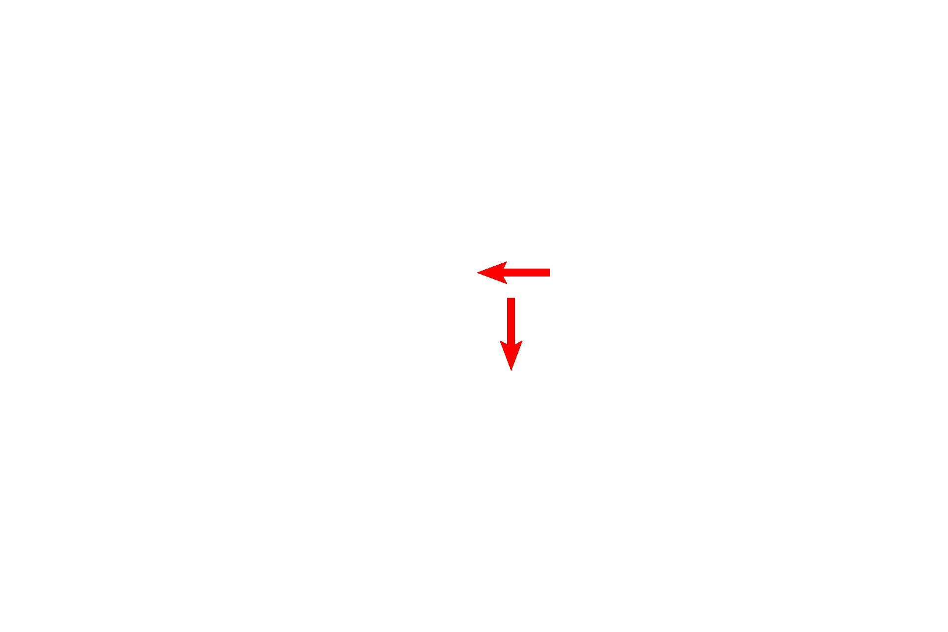 Epithelium <p>The ductus deferens is lined with pseudostratified epithelium overlying a thin lamina propria. The most diagnostic feature, however, is its thick muscular coat of inner and outer tunics of longitudinally oriented smooth muscle and a middle coat of circular muscle. The differentiation between the green connective tissue and red smooth muscle is readily obvious with this trichrome stain.  40x</p>
