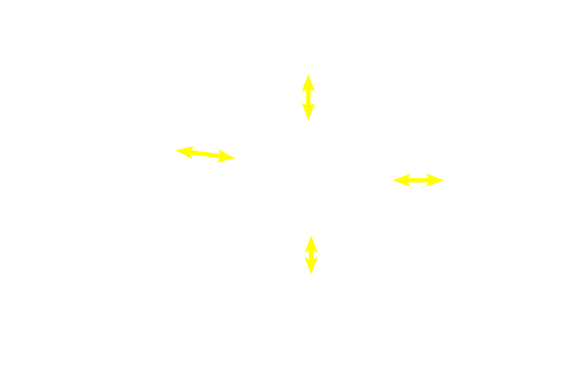 Middle circular muscle <p>The ductus deferens is lined with pseudostratified epithelium overlying a thin lamina propria. The most diagnostic feature, however, is its thick muscular coat of inner and outer tunics of longitudinally oriented smooth muscle and a middle coat of circular muscle. The differentiation between the green connective tissue and red smooth muscle is readily obvious with this trichrome stain.  40x</p>
