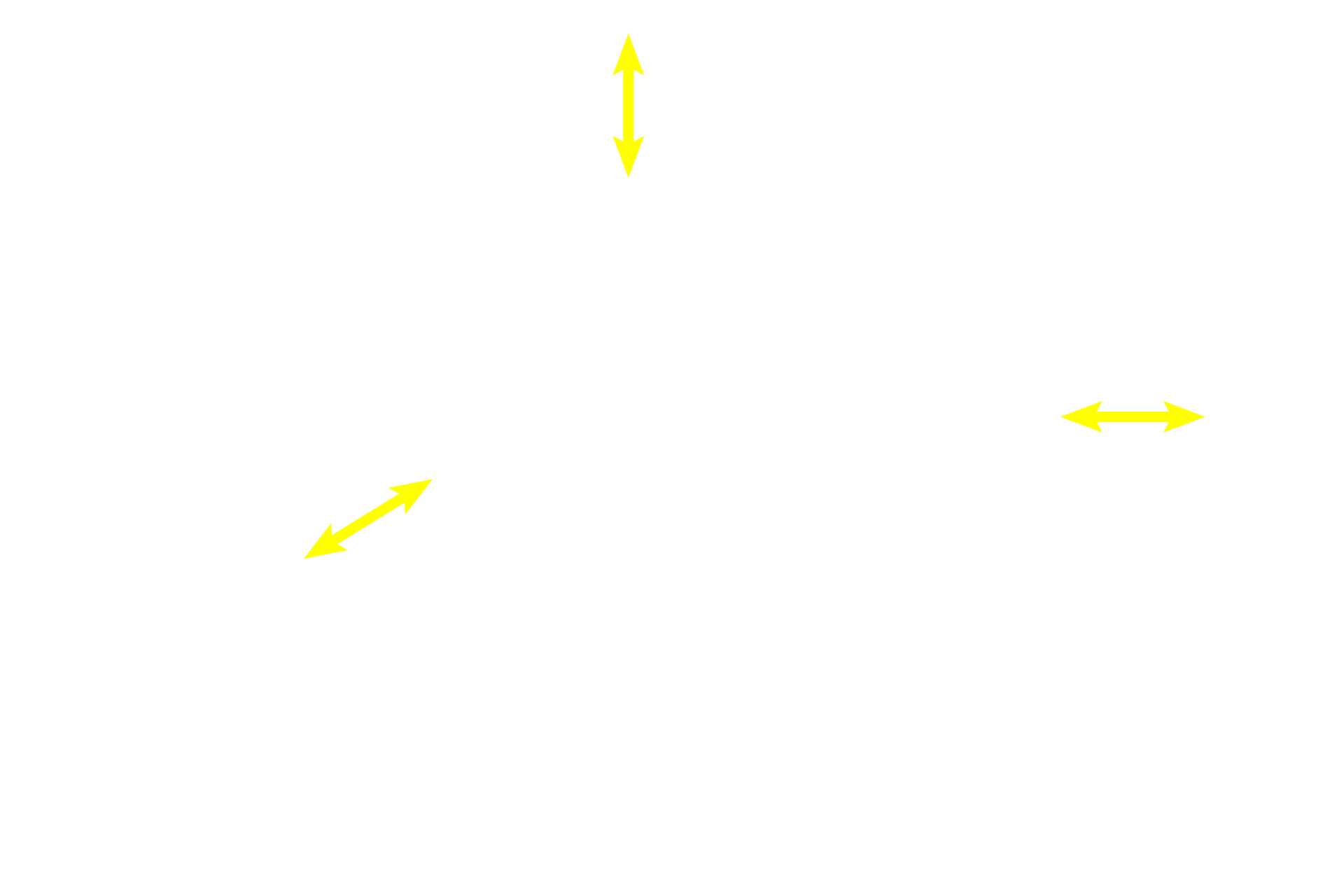 Outer longitudinal muscle <p>The ductus deferens is lined with pseudostratified epithelium overlying a thin lamina propria. The most diagnostic feature, however, is its thick muscular coat of inner and outer tunics of longitudinally oriented smooth muscle and a middle coat of circular muscle. The differentiation between the green connective tissue and red smooth muscle is readily obvious with this trichrome stain.  40x</p>
