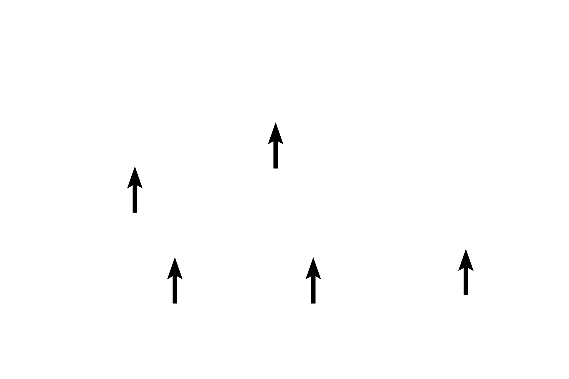 Arches <p>The central lumen of the seminal vesicle has been partitioned by primary, secondary and tertiary arches composed of the lining epithelium and its underlying lamina propria. The presence of a central lumen and the numerous, intersecting arches surrounding it help to distinguish the seminal vesicle from the ampulla of the oviduct. At the periphery of the gland is a layer of smooth muscle.  100x </p>
