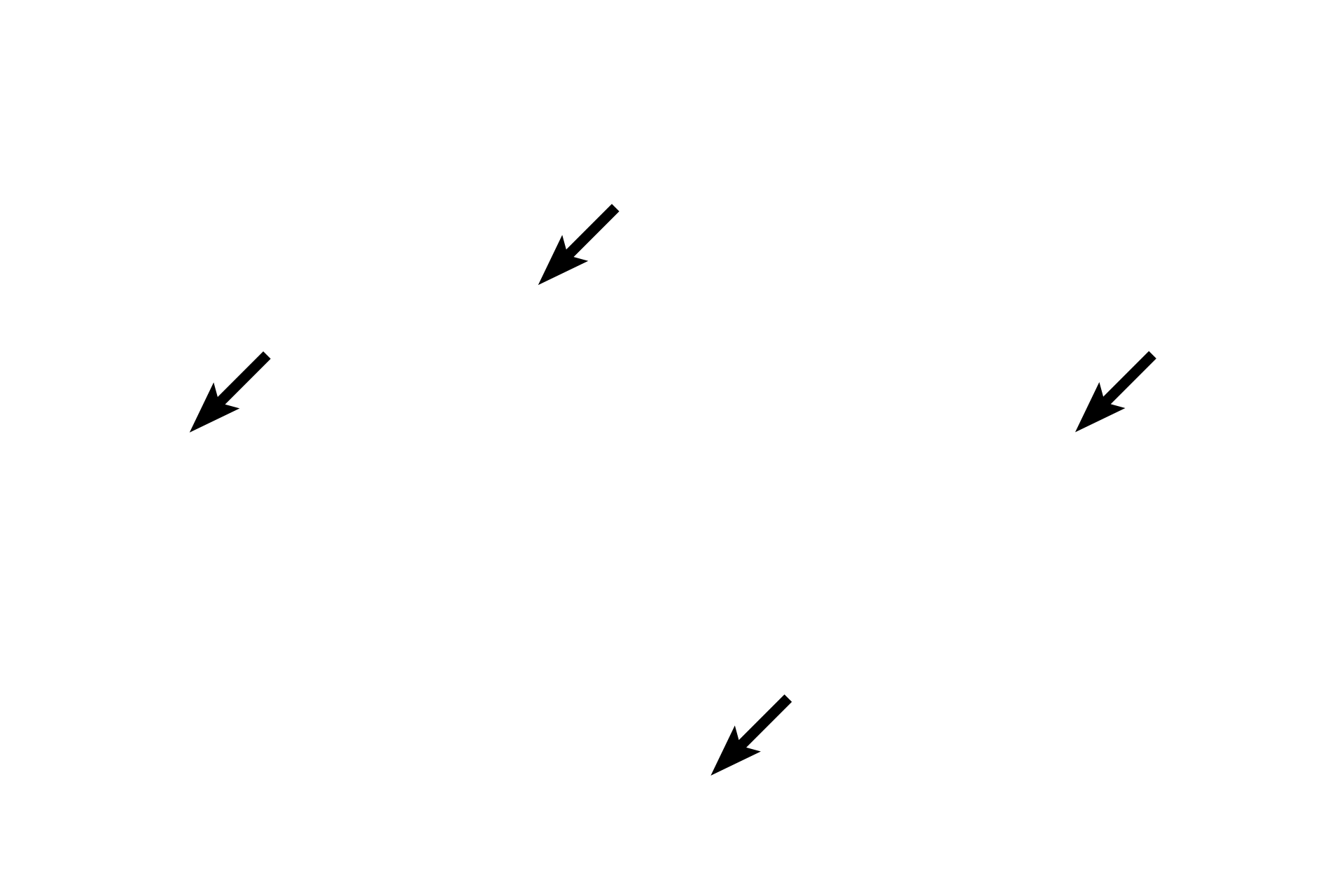  - Lumen subdivisions <p>The central lumen of the seminal vesicle has been partitioned by primary, secondary and tertiary arches composed of the lining epithelium and its underlying lamina propria. The presence of a central lumen and the numerous, intersecting arches surrounding it help to distinguish the seminal vesicle from the ampulla of the oviduct. At the periphery of the gland is a layer of smooth muscle.  100x </p>
