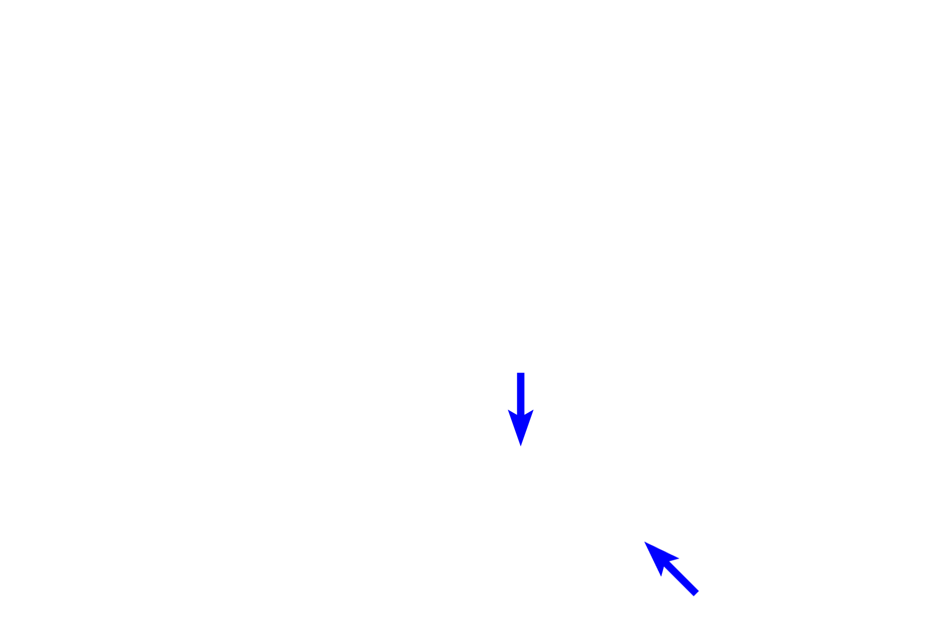  - Cement line > <p>The outer boundary of the newly formed osteon is marked by a cement line that appears as a basophilic ring around the osteon due to its higher concentration of ground substance.</p>
