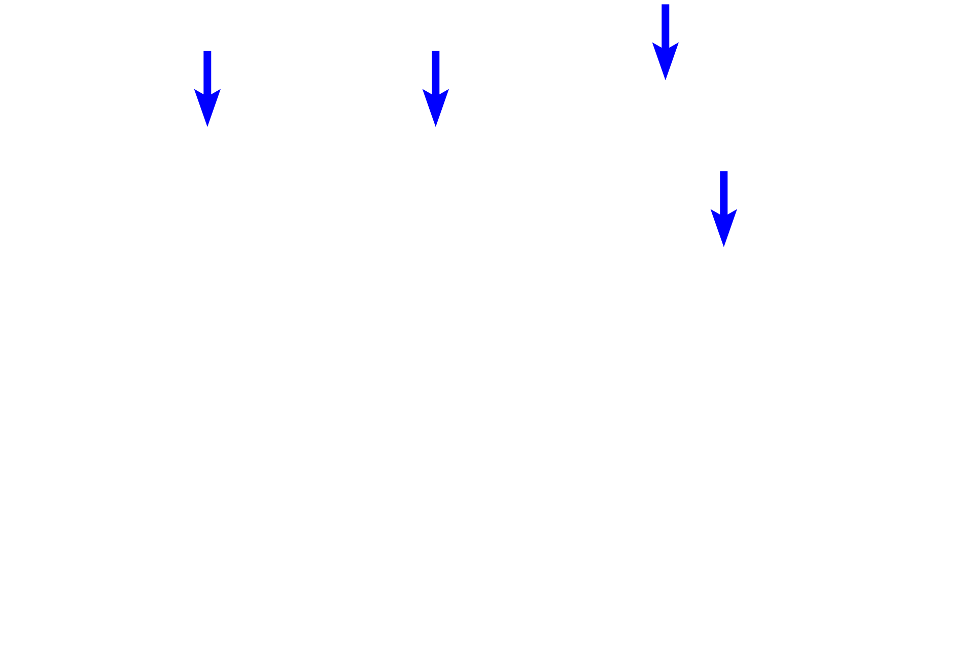  - Osteoclasts <p>This series of images shows stages in the life span of a bone remodeling unit (BRU), a two-stage process whereby cortical bone is remodeled from within.  The first stage of a BRU begins with osteoclastic erosion of bone in a “resorption canal” that advances lengthwise within the bone, forming a tunnel.  In the second stage, osteoblasts deposit bone, beginning at the origin of the resorption canal, which creates the “closing end” of the BRU. The continued centripal deposition of lamellae creates a new osteon.</p>
