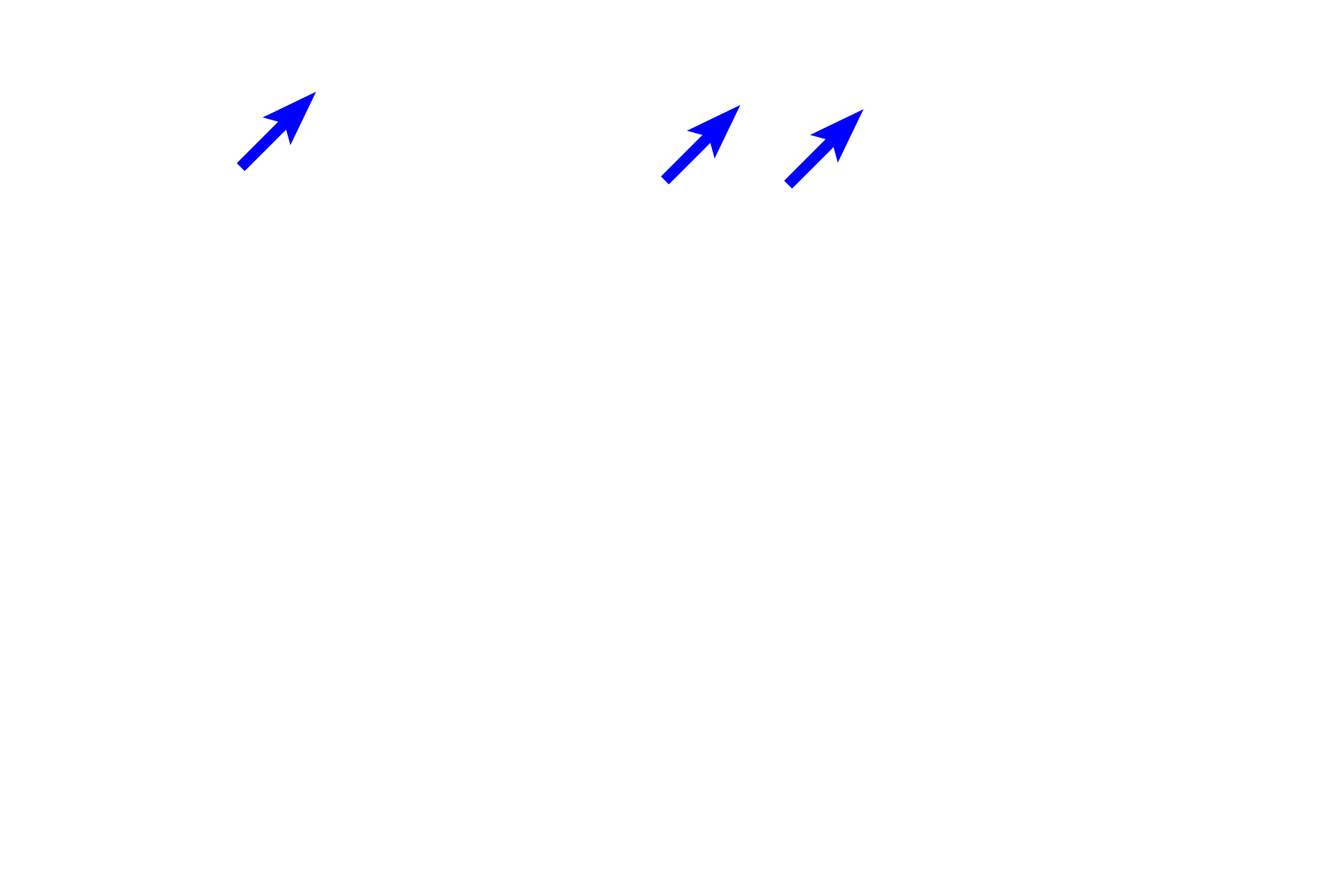 Gastric pits <p>In addition to the surface sheet gland, the stomach also possesses numerous simple, branched tubular glands that descend into the underlying tissue.  These glands consist of branching secretory tubules.  The tubules empty into surface invaginations (gastric pits) that serve as ducts for the glands.  These glands are examples of tubular glands that do not secrete mucus.  Rather, they gland secrete stomach acid and digestive enzymes.  Fundic stomach 200x</p>
