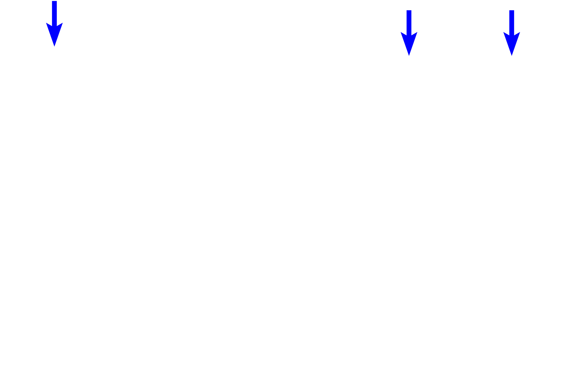 Gastric pits <p>This image of the stomach shows the structure of a simple, branched tubular gland.  The secretory sheet lining the surface invaginates to form a gastric pit that acts as a duct for the gland.  The secretory portions of the gland branch at their junction with the gastric pit.  Fundic stomach 400x</p>
