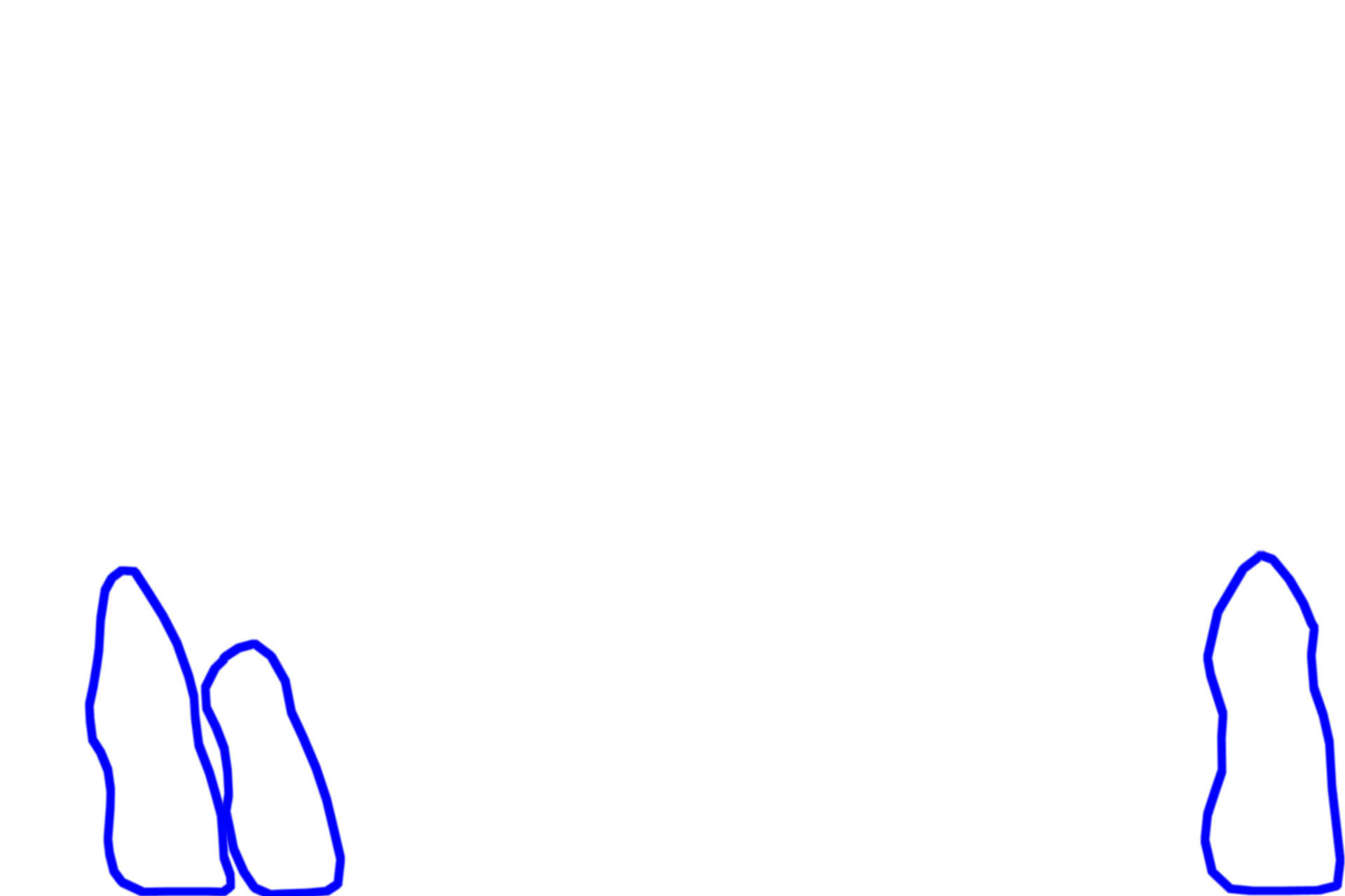  - Secretory tubules <p>This image of the stomach shows the structure of a simple, branched tubular gland.  The secretory sheet lining the surface invaginates to form a gastric pit that acts as a duct for the gland.  The secretory portions of the gland branch at their junction with the gastric pit.  Fundic stomach 400x</p>
