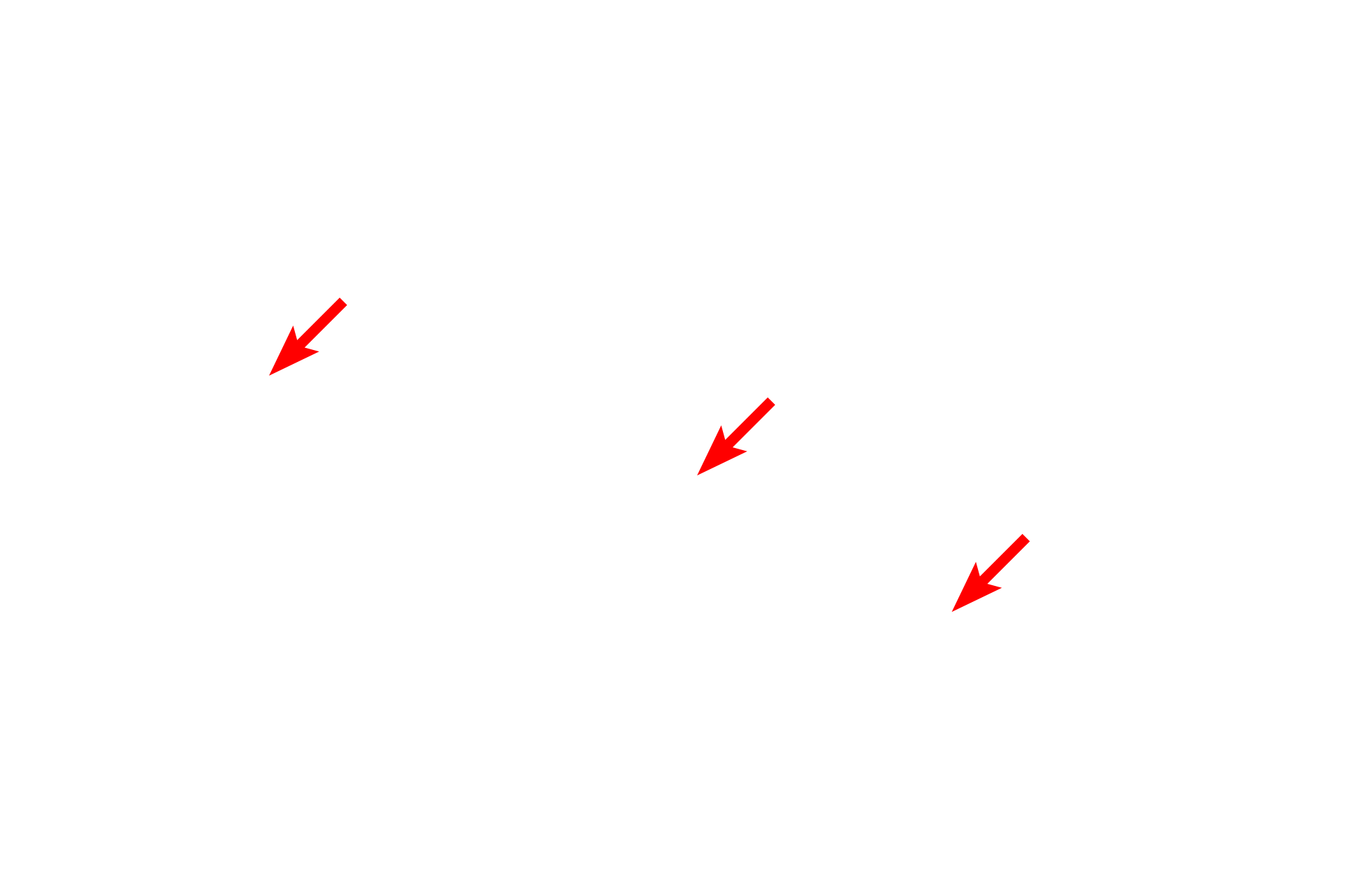 Perinuclear space <p>The nuclear envelope contains openings called nuclear pores, which consist of a complex of proteins encircling an opening.  Nuclear pores regulate the bi-directional transit of materials between the cytoplasm and nucleus.  In this image, six pores are visible and are marked by sites where the perinuclear space is obscured and the heterochromatin is interrupted.  38,000x</p>
