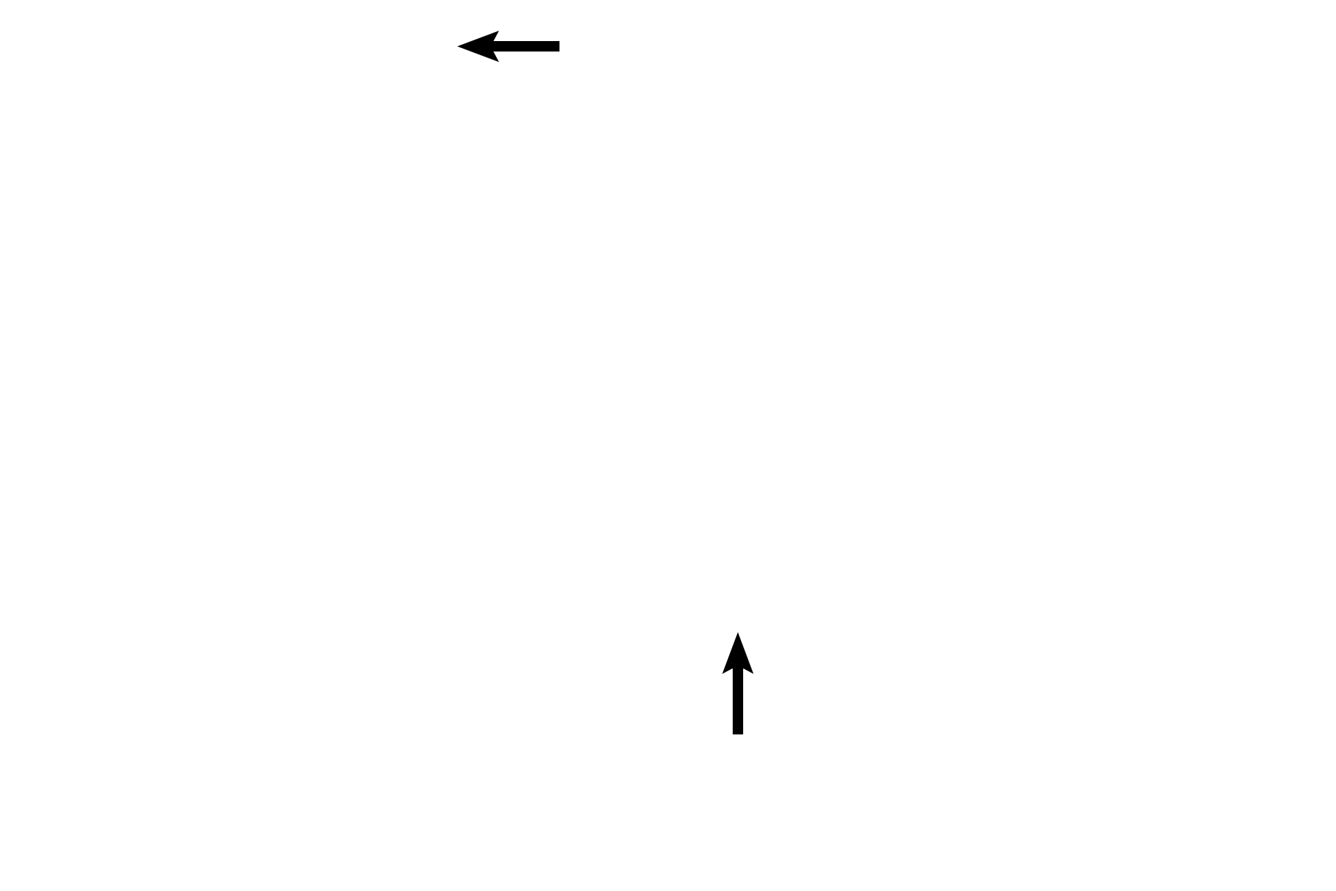 Helicotrema <p>Another section of a non-human cochlea shows this bony tube coiled into a spiral. The cochlear duct is centrally located within the cochlea, dividing it into a scala vestibuli, lying above the cochlear duct, and a scala tympani lying below. Scala vestibuli and scala tympani are continuous at the tip of the cochlea at the helicotrema. 40x</p>
